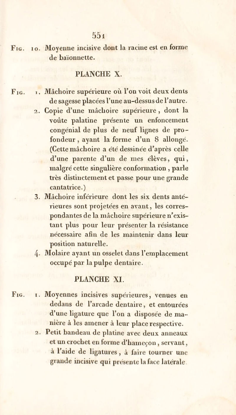 Fig. i F IG. Fig. 55 i o. Moyenne incisive dont la racine est en forme de baïonnette. PLANCHE X. 1. Mâchoire supérieure où l’on voit deux dents de sagesse placées l’une au-dessus de l’autre. 2. Copie d’une mâchoire supérieure , dont la voûte palatine présente un enfoncement congénial de plus de neuf lignes de pro¬ fondeur , ayant la forme d’un 8 allongé. (Cette mâchoire a été dessinée d’après celle d’une parente d’un de mes élèves, qui, malgré cette singulière conformation , parle très distinctement et passe pour une grande cantatrice.) 3. Mâchoire inférieure dont les six dents anté¬ rieures sont projetées en avant, les corres¬ pondantes de la mâchoire supérieure n’exis¬ tant plus pour leur présenter la résistance nécessaire afin de les maintenir dans leur position naturelle. 4- Molaire ayant un osselet dans l’emplacement occupé par la pulpe dentaire. PLANCHE XI. 1. Moyennes incisives supérieures, venues en dedans de l’arcade dentaire, et entourées d’une ligature que l’on a disposée de ma¬ nière à les amener à leur place respective. 2. Petit bandeau de platine avec deux anneaux et un crochet en forme d’hameçon, servant, à l’aide de ligatures , à faire tourner une grande incisive qui présente la face latérale