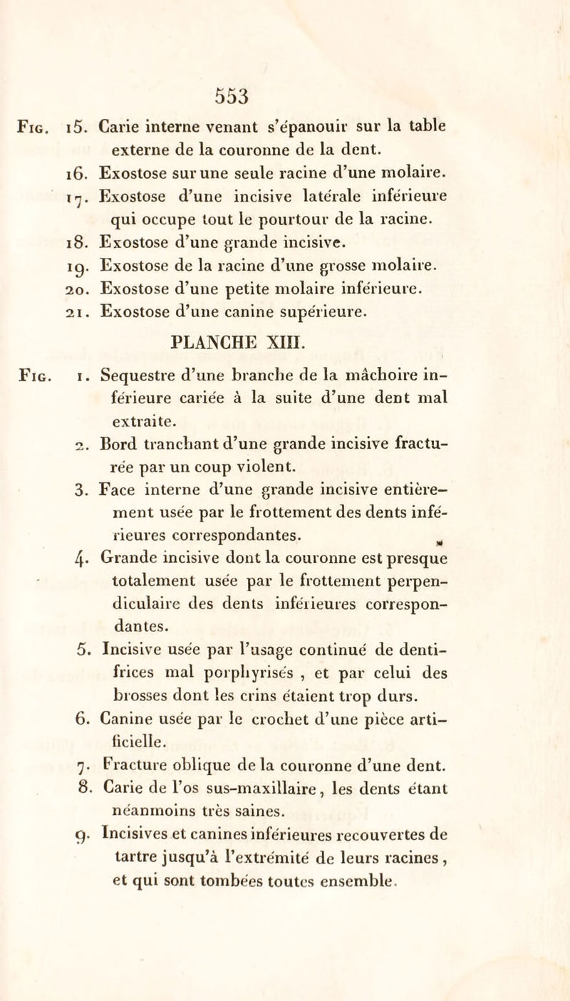 Fig. i5. Carie interne venant s’épanouir sur la table externe de la couronne de la dent. 16. Exostose sur une seule racine d’une molaire. 17. Exostose d’une incisive latérale inférieure qui occupe tout le pourtour de la racine. 18. Exostose d’une grande incisive. ig. Exostose de la racine d’une grosse molaire. 20. Exostose d’une petite molaire inférieure. 21. Exostose d’une canine supérieure. PLANCHE XIII. Fig. 1. Séquestre d’une branche de la mâchoire in¬ férieure cariée à la suite d’une dent mal extraite. 2. Bord tranchant d’une grande incisive fractu¬ rée par un coup violent. 3. Face interne d’une grande incisive entière¬ ment usée par le frottement des dents infé¬ rieures correspondantes. 4. Grande incisive dont la couronne est presque totalement usée par le frottement perpen¬ diculaire des dents inférieures correspon¬ dantes. 5. Incisive usée par l’usage continué de denti¬ frices mal porphyrisés , et par celui des brosses dont les crins étaient trop durs. 6. Canine usée par le crochet d’une pièce arti¬ ficielle. 7. Fracture oblique delà couronne cl’une dent. 8. Carie de l’os sus-maxillaire, les dents étant néanmoins très saines. g. Incisives et canines inférieures recouvertes de tartre jusqu’à l’extrémité de leurs racines , et qui sont tombées toutes ensemble.
