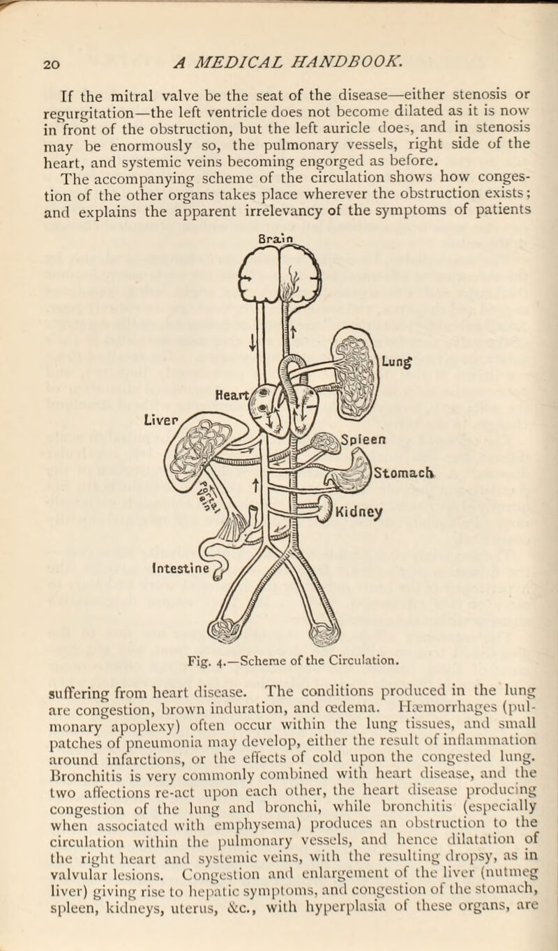 If the mitral valve be the seat of the disease—either stenosis or regurgitation—the left ventricle does not become dilated as it is now in front of the obstruction, but the left auricle does, and in stenosis may be enormously so, the pulmonary vessels, right side of the heart, and systemic veins becoming engorged as before. The accompanying scheme of the circulation shows how conges¬ tion of the other organs takes place wherever the obstruction exists; and explains the apparent irrelevancy of the symptoms of patients Brain suffering from heart disease. The conditions produced in the lung are congestion, brown induration, and oedema. Hemorrhages (pul¬ monary apoplexy) often occur within the lung tissues, and small patches of pneumonia may develop, either the result of inflammation around infarctions, or the effects of cold upon the congested lung. Bronchitis is very commonly combined with heart disease, and the two affections re-act upon each other, the heart disease producing congestion of the lung and bronchi, while bronchitis (especially when associated with emphysema) produces an obstruction to the circulation within the pulmonary vessels, and hence dilatation of the right heart and systemic veins, with the resulting dropsy, as in valvular lesions. Congestion and enlargement of the liver (nutmeg liver) giving rise to hepatic symptoms, and congestion of the stomach, spleen, kidneys, uterus, &c., with hyperplasia of these organs, are