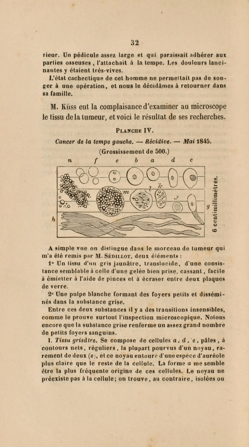 rieur. Un pédicule assez large et qui paraissait adhérer aux parties osseuses , l’attachait à la tempe. Les douleurs lanci¬ nantes y étaient très-vives. L’état cachectique de cet homme ne permettait pas de son¬ ger à une opération, et nous le décidâmes à retourner dans sa famille. M. Küss eut la complaisance d’examiner au microscope le tissu delà tumeur, et voici le résultat de ses recherches. Planche IV. Cancer de la tempe gauche. —• Récidive. — Mai 1845. (Grossissement de 500.) n f e h a d c S 9 I = O u 50 A simple vue on distingue dans le morceau de tumeur qui m’a été remis par M. Sédillot, deux éléments : 1° Un tissu d’un gris jaunâtre, translucide, d'une consis¬ tance semblable à celle d’une gelée bien prise, cassant, facile à émietter à l’aide de pinces et à écraser entre deux plaques de verre. 2° Une pulpe blanche formant des foyers petits et dissémi¬ nés dans la substance grise. Entre ces deux substances il y a des transitions insensibles, comme le prouve surtout l’inspection microscopique. Notons encore que la substance grise renferme un assez grand nombre de petits foyers sanguins. I. Tissu grisâtre. Se compose de cellules a. d . e. pâles , à contours nets, réguliers, la plupart pourvus d'un noyau, ra¬ rement de deux (ej, et ce noyau entoure d’uneespéce d’auréole plus claire que le reste de la cellule. La forme a me semble être la plus fréquente origine de ces cellules. Le noyau ne préexiste pas à la cellule; on trouve, au contraire, isolées ou