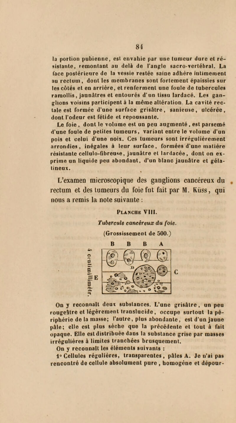 la portion pubienne, est envahie par une tumeur dure et ré¬ sistante, remontant au delà de l’angle sacro-vertébral. La face postérieure de la vessie restée saine adhère intimement au rectum, dont les membranes sont fortement épaissies sur les côtés et en arrière, et renferment une foule de tubercules ramollis, jaunâtres et entourés d'un tissu lardacé. Les gan¬ glions voisins participent à la même altération La cavité rec¬ tale est formée d’une surface grisâtre, sanieuse, ulcérée, dont l’odeur est fétide et repoussante. Le foie , dont le volume est un peu augmenté , est parsemé d’une foule de petites tumeurs, variant entre le volume d’un pois et celui d’une noix. Ces tumeurs sont irrégulièrement arrondies, inégales à leur surface, formées d’une matière résistante cellulo-fibreuse, jaunâtre et lardacée, dont on ex¬ prime un liquide peu abondant, d’un blanc jaunâtre et géla¬ tineux. L’examen microscopique des ganglions cancéreux du rectum et des tumeurs du foie fut fait par M. Küss, qui nous a remis la note suivante : Planche VIII. Tubercule cancéreux du foie. (Grossissement de 500.) B B B A On y reconnaît deux substances. L’une grisâtre, un peu rougeâtre et légèrement translucide, occupe surtout la pé¬ riphérie de la masse; l’autre, plus abondante, est d'un jaune pâle; elle est plus sèche que la précédente et tout à fait opaque. Elle est distribuée dans la substance grise par masses irrégulières à limites tranchées brusquement. On y reconnaît les éléments suivants : 1° Cellules régulières, transparentes, pâles A. Je n'ai pas rencontré de cellule absolument pure , homogène et dépour-