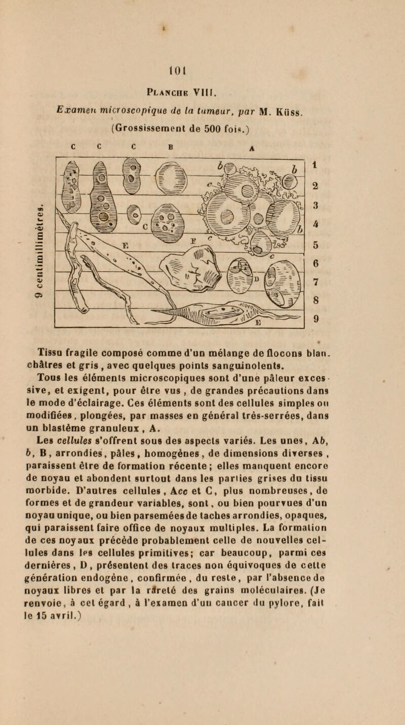 Planchk VIII. Examen microscopique do la tumeur, par M. Kiiss. (Grossissement de 500 fois.) c c c B a 1 2 3 4 5 6 7 8 9 Tissa fragile composé comme d’un mélange de flocons blau. châtres et gris , avec quelques points sanguinolents. Tous les éléments microscopiques sont d’une pâleur exces sive, et exigent, pour être vus , de grandes précautions dans le mode d’éclairage. Ces éléments sont des cellules simples ou modifiées, plongées, par masses en général très-serrées, dans un blastème granuleux , A. Les cellules s'offrent sous des aspects variés. Les unes, Ab, b, B, arrondies, pâles, homogènes , de dimensions diverses , paraissent être de formation récente ; elles manquent encore de noyau et abondent surtout dans les parties grises du tissu morbide. D’autres cellules, Acc et C, plus nombreuses.de formes et de grandeur variables, sont, ou bien pourvues d’un noyau unique, ou bien parseméesde taches arrondies, opaques, qui paraissent faire office de noyaux multiples. La formation de ces noyaux précède probablement celle de nouvelles cel¬ lules dans les cellules primitives; car beaucoup, parmi ces dernières , D , présentent des traces non équivoques de cette génération endogène , confirmée , du reste, par l’absence de noyaux libres et par la râreté des grains moléculaires. (Je renvoie, à cet égard , à l’examen d’uu cancer du pylore, fait le 15 avril.)