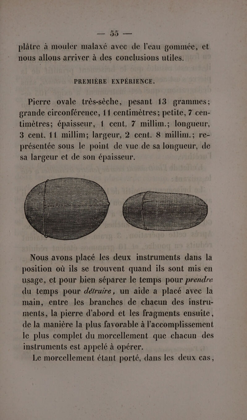 a a plâtre à mouler malaxé avec de l’eau gommée, et nous allons arriver à des conclusions utiles. = PREMIÈRE EXPÉRIENCE. Pierre ovale très-sèche, pesant 13 grammes; grande circonférence, 11 centimètres; petite, 7 cen- timètres; épaisseur, { cent. 7 millim.; longueur, 3 cent. 11 millim; largeur, 2 cent. 8 millim.; re- présentée sous le point de vue de sa longueur, de sa largeur et de son épaisseur. Nous avons placé les deux instruments dans la position où ils se trouvent quand ils sont mis en usage, et pour bien séparer le temps pour prendre du temps pour détruire, un aïde à placé avec la main, entre les branches de chacun des instru- ments, la pierre d’abord et les fragments ensuite, de la manière la plus favorable à laccomplissement le plus complet du morcellement que chacun des instruments est appelé à opérer. Le morcellement étant porté, dans les deux € Cas ,