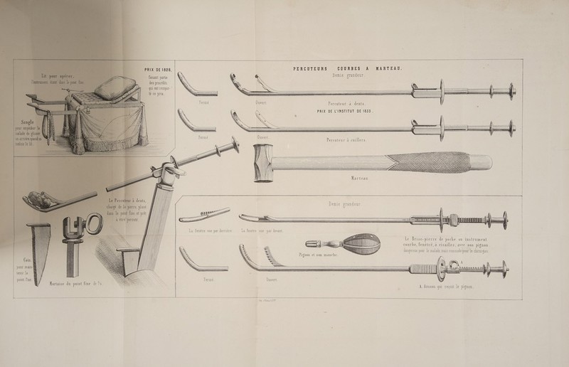 PRIX DE 1828 .PERCUTEURS COURBES A MARTEAU, , Demie grandeur. faisant partie des procédés qui ont TEMPOr- té ce prix. t Ouvert Percuteur à dents. PRIX DE L'INSTITUT DE 1833. Percuteu l' Marteau. Demie grandeur. Le Brise-pierre de poche ou instrument courbe, Ffenétré, à cisailles, avec son pignon. dangereux pour le malade, mais commode pour Le chirurgien “ll ; M NI 1/1 Coin. À pour main-k temr le Fermé. Ouvert. pont fixe. \ NT À \ À. Anneau qui recoit le pignon. Jp d'Aubezt de Ce