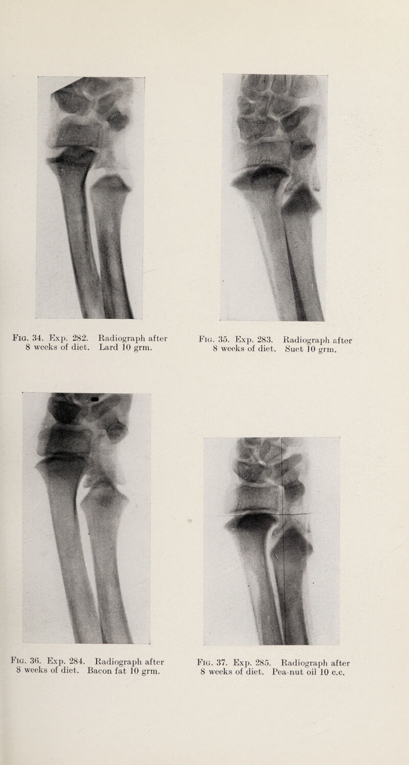 Fig. 34. Exp. 282. Radiograph after Fig. 35. Exp. 283. Radiograph after 8 weeks of diet. Lard 10 grm. 8 weeks of diet. Suet 10 grm. Fig. 30. Exp. 284. Radiograph after Fig. 37. Exp. 285. Radiograph after