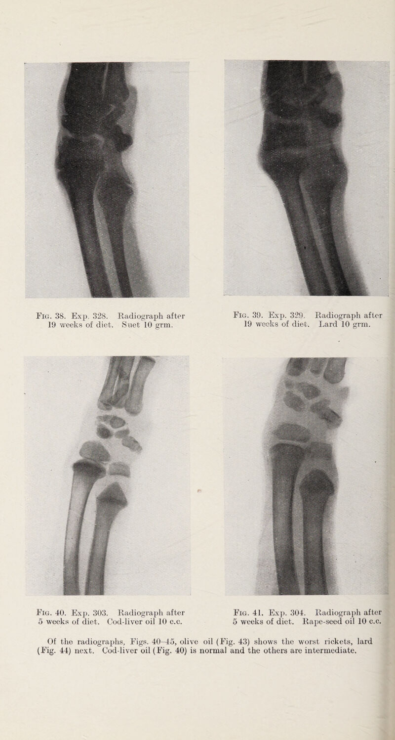 19 weeks of diet. Suet 10 grm. 19 weeks of diet. Lard 10 grm. Fig. 40. Exp. 303. Radiograph after Fig. 41. Exp. 304. Radiograph after 5 weeks of diet. Cod-liver oil 10 c.c. 5 weeks of diet. Rape-seed oil 10 c.c. Of the radiographs, Figs. 40-45, olive oil (Fig. 43) shows the worst rickets, lard