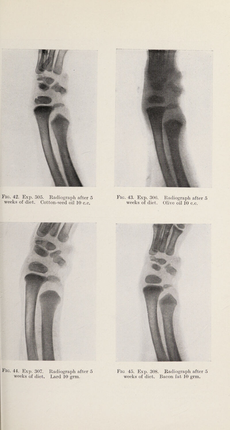 weeks of diet. Cotton-seed oil 10 c.c. weeks of diet. Olive oil 10 c.c. Fig. 44. Exp. 307. Radiograph after 5 weeks of diet. Lard 10 grm. Fig 45. Exp. 308. Radiograph after 5 weeks of diet. Bacon fat 10 grm.