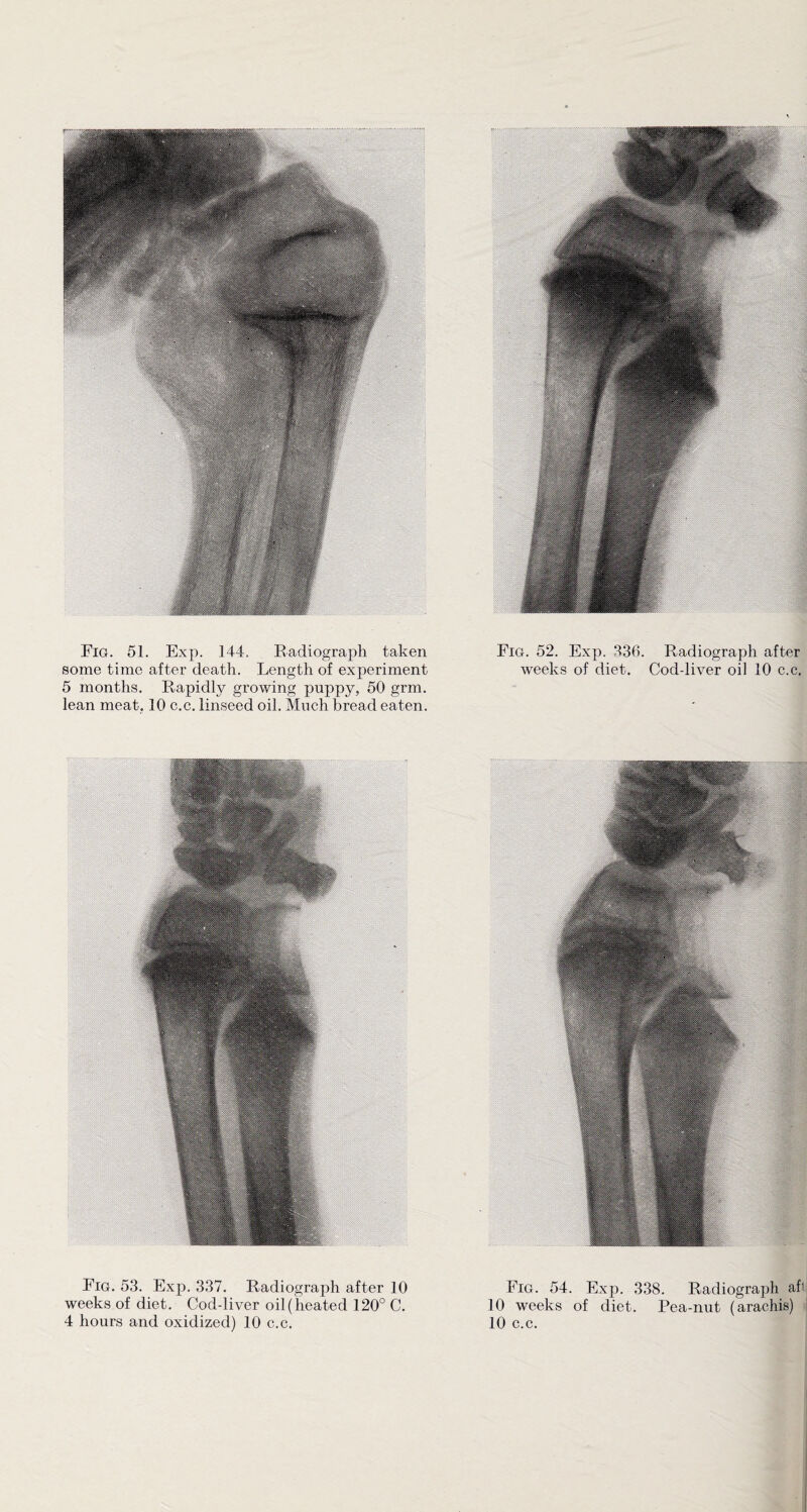 some time after death. Length of experiment weeks of diet. Coddiver oil 10 c.c. 5 months. Rapidly growing puppy, 50 grm. lean meat, 10 c.c. linseed oil. Much bread eaten. Fig. 53. Exp. 337. Radiograph after 10 Fig. 54. Exp. 338. Radiograph afi weeks of diet. Coddiver oil (heated 120° C. 10 weeks of diet. Pea-nut (arachis)