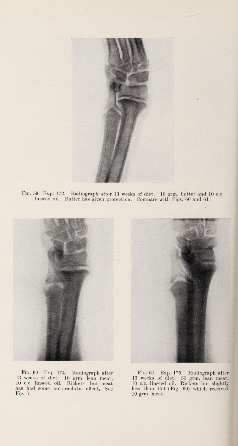 linseed oil. Butter has given protection. Compare with Figs. 60 and 61. Fig. 60. Exp. 174. Radiograph after 13 weeks of diet. 10 grm. lean meat, 10 c.c. linseed oil. Rickets—but meat has had some anti-rachitic effect. See Fig. 7. Fig. 61. Exp. 175. Radiograph after 13 weeks of diet. 50 grm. lean meat, 10 c.c. linseed oil. Rickets but slightly less than 174 (Fig. 60) which received 10 grm. meat.