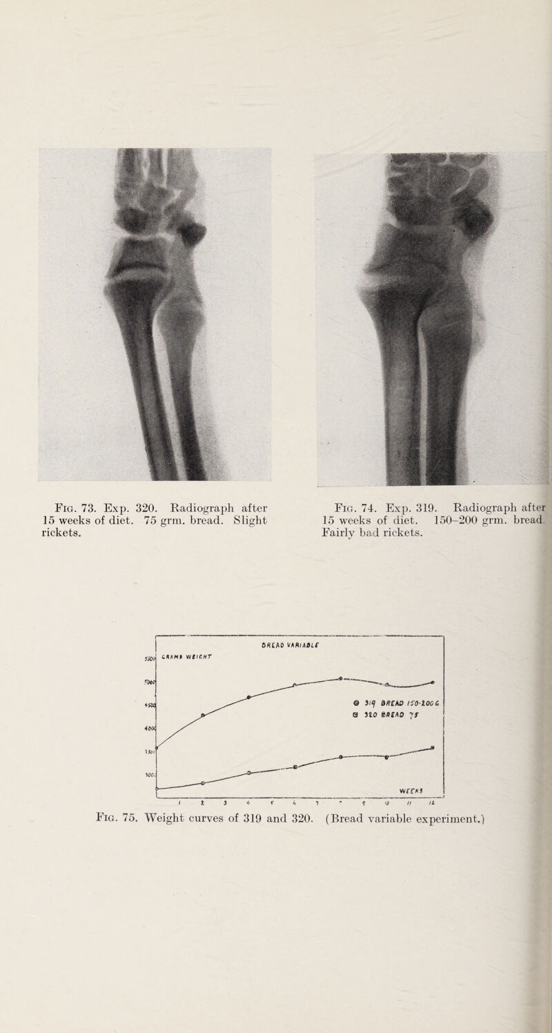 15 weeks of diet. 75 grm. bread. Slight 15 weeks of diet. 150-200 grm. bread- rickets. Fairly bad rickets. Fig. 75. Weight curves of 319 and 320. (Bread variable experiment.)