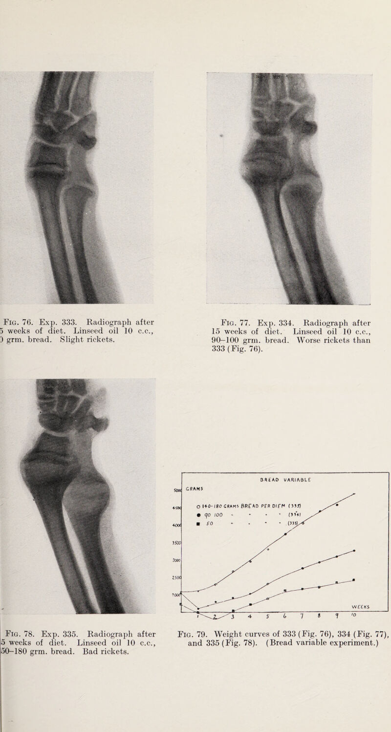 weeks of diet. Linseed oil 10 c.c., grm. bread. Slight rickets. 15 weeks of diet. Linseed oil 10 c.c., 90—100 grm. bread. Worse rickets than 333 (Fig. 76). Fig. 78. Exp. 335. Radiograph after Fig. 79. Weight curves of 333 (Fig. 76), 334 (Fig. 77), 5 weeks of diet. Linseed oil 10 c.c., and 335 (Fig. 78). (Bread variable experiment.) 50-180 grm. bread. Bad rickets.