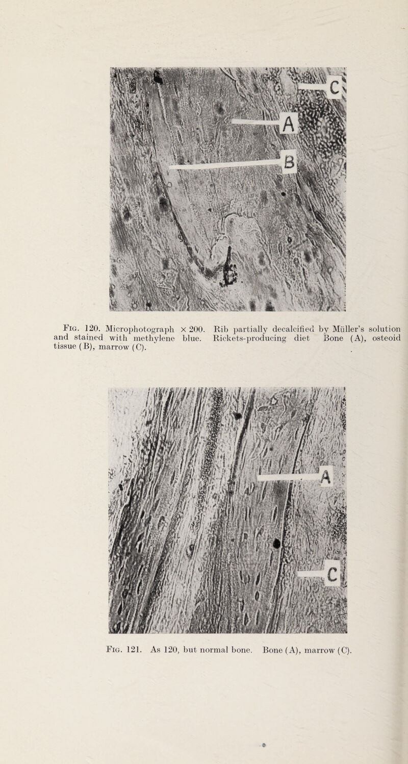 and stained with methylene blue. Rickets-producing diet Bone (A), osteoid tissue (B), marrow (C).