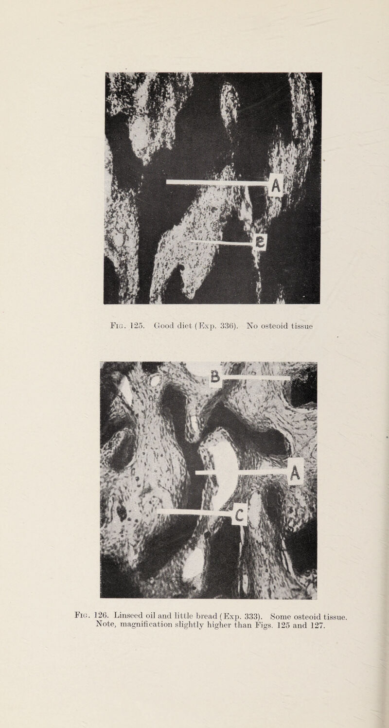 Fig. 126. Linseed oil and little bread (Exp. 333). Some osteoid tissue. Note, magnification slightly higher than Figs. 125 and 127.