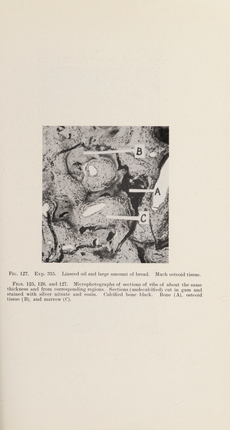 Fig. 127. Exp. 335. Linseed oil and large amount of bread. Much osteoid tissue. Figs. 125, 126, and 127. Microphotographs of sections of ribs of about the same thickness and from corresponding regions. Sections (undecalcified) cut in gum and stained with silver nitrate and eosin. Calcified bone black. Bone (A), osteoid tissue (B), and marrow (C).
