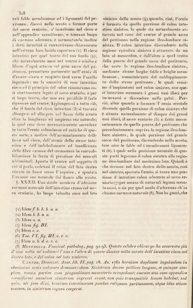 raìi falde membranose ed i ligamenti del pe¬ ritoneo, discesi nello scroto a formar parte del sacco erniario, s’ inserivano nel cieco e nell’appendice vermiforme, e tenevan luogo di carnosa aderenza, e sormontando inoltre i detti intestini si convertivano chiaramente nell’esterna loro lucida copertura (i). Il cieco intestino per quel tratto del suo fondo (2), che naturalmente anco nel ventre è sciolto e libero d’ogni attacco col gran sacco del pe¬ ritoneo, permetteva parimente nell’ernia di d’essere alzalo e respinto insù verso l’anello inguinale; ma la sommità di esso intestino cieco ed il principio del colon rimanevano co» sì strettamente legate al sacco erniario, e per sì largo tratto, che non era possibile il farle ripassare nel ventre. Aggiungevasi a tutto ciò, che il fondo del cieco intestino (3) si trovava allungato ed allargalo nel basso dello scroto oltre ia lunghezza ed ampiezza sua naturale; la qual cosa deve necessariamente succedere in tutte l’ernie voluminose ed antiche di que¬ sta sorte, a motivo dell’accumulamento delle fecce nel cieco, dell’atonia dello stesso inte¬ stino e dell’indebolimento ed insufficenza delle fibre carnose del eremastere in contrab¬ bilanciare la forza di pressione dei muscoli addominali. Aperto il ventre nel soggetto di cui si parla, vedevasi il colon del lato destro stirato in basso verso l’inguine, e spostata l’unione sua naturale dal fianco allo scroto. §. XXXII. u na simile maniera d’adesione carnosa naturale delTintestino crasso col sac¬ co erniario, ha luogo talvolta anco nel lato sinistro dello scroto (4);quando, cioè, l’ernia è formata da quella porzione di colon inte¬ stino sinistro, la quale sta naturalmente at¬ taccata nel cavo del ventre al grande sacco del peritoneo nella regione ileo-lombare si¬ nistra. Il colon intestino discendente nella regione epicolica sinistra è attaccato da un Iato al mesocolon, e dall’altro a quel tratto della parete del grande sacco del peritoneo, ohe veste la regione ileo-lombare sinistra, mediante alcune larghe falde e briglie mem¬ branose , somministrate dal raddoppiamen¬ to dello stesso peritoneo , le quali cessa¬ no d’impiantarsi nel colon sinistro, ove que¬ st intestino sormonta i grossi vasi iliaci per incurvarsi e discendere nella pelvi . Per¬ orò, allor quando a formare 1’ ernia scrotale discende quella porzione di colon sinistro che è situata naturalmente al disopra dei grossi vasi iliaci, il sacco erniario (5) è fatto neces¬ sariamente da quella parete del peritoneo che precedentemente copriva la regione ileo-lom¬ bare sinistra , la quale porzione del grande sacco del peritoneo, discendendo nello scr oto, trae seco le falde ed i membranosi ligamen¬ ti (6), i quali nella posizione naturale di que¬ ste parti legavano il colon sinistro alla regio¬ ne ileo-lombare del medesimo lato. Quindi è che siccome nel lato destro dello scroto, così nel sinistro, spaccata l’ernia, si trova una por¬ zione d’ intestino colon aderente al sacco er¬ niario (7) per mezzo di naturali legami mem¬ branosi, o sia per quel modo d’aderenza ch'io chiamo carnosa naturale (8). Non ha guari, che (1) Idem f b. b. b a. a, (2) Idem b. b. a. a. (3) Idem a. a. (4) Idem fig. III. (5) Idem e. e. (6) The. / /, fig. Ili, c. c. c. (7) Idem a. b. d. c. c. c. (8) Monteggia. Fascicul. patholog., pag. 91-93. Questo celebre chirurgo ha osservato più d'una coìta ne' cadaveri V una e Valtra di queste discese nello scroto dell intestino cieco nel destro lato, e del colon nel loto sinistro. Camper, Demonst. Anat.lib. II,pag. 18. An. 1761 herniam duplicem inguinalem in obesissimi senis cadavere demonstrabam. Sinistrarti decern pollices longoni, et quinque am¬ piam, temila partim cum pinguedinoso mesenterio occupabant; coecum una cum appendice vermiformi annuium sinistrimi ingressi erant, non quia transpositio locum habebat, sed quia, uti jam dixi, tenui um intestinorum pondus reliquum peritonaeum, atque ideo edam coecum, in sinistrimi inguen coegerat.