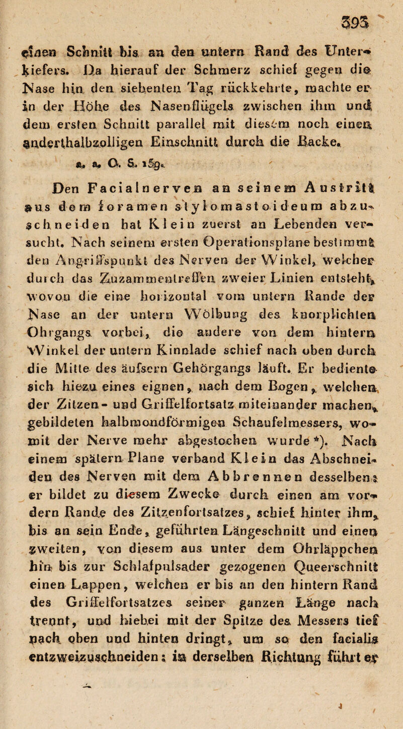 595 einen Schuht bis an den untern Rand des Unter-» Kiefers. Da hierauf der Schmerz schief gegen di© N ase hin den siebenten Tag rückkehrte, machte er in der Hohe des Nasenflügels zwischen ihm und dem ersten Schnitt parallel mit diesem noch einen ^nderthalbzolligen Einschnitt durch die Backe. ft. ft» (^9 S» 1 Cft. Den Facialnervea an seinem Austritt aus dem foramen st yfomastoideum abzu^ schneiden hat Klein zuerst an Lebenden ver¬ sucht, Nach seinem ei sten Operationsplane bestimm! den Angriffspunkt des Nerven der Winkel, welcher duich das Zusammentreffen zweier Linien entsteht* wovon die eine horizontal vom untern Rande der Nase an der untern Wölbung des koorpiichten Ohrgangs vorbei, di© andere von dem hintern Winkel der untern Kinnlade schief nach oben durch die Mitte des äufsern Gehörgangs läuft. Er bedient© sich hiezu eines eignen, nach dem Bogen* welchen der Zitzen- und Griffelfortsatz miteinander machen* gebildeten halbmondförmigen SchaufeSmessers, wo¬ mit der Nerve mehr abgestochen wurde *). Nach einem spätem Plan© verband Klein das AbschneL den des Nerven mit dem Ab brennen desselben? er bildet zu diesem Zweck© durch einen am vor-» dern Rande des Zitzenforlsatzes, schief hinter ihm* bis an sein Ende* geführten Längeschnitt und einen zweiten, von diesem aus unter dem Ohrläppchen hin bis zur Schlafpulsader gezogenen Queerschnitt einen Lappen, welchen er bis an den hintern Rand des Gi iffeifortsatzes seiner ganzen Länge nach trennt, und hiebei mit der Spitze des Messers tie£ nach eben und hinten dringt* um so den facialis entzweizuschneiden; in derselben Richtung führtet