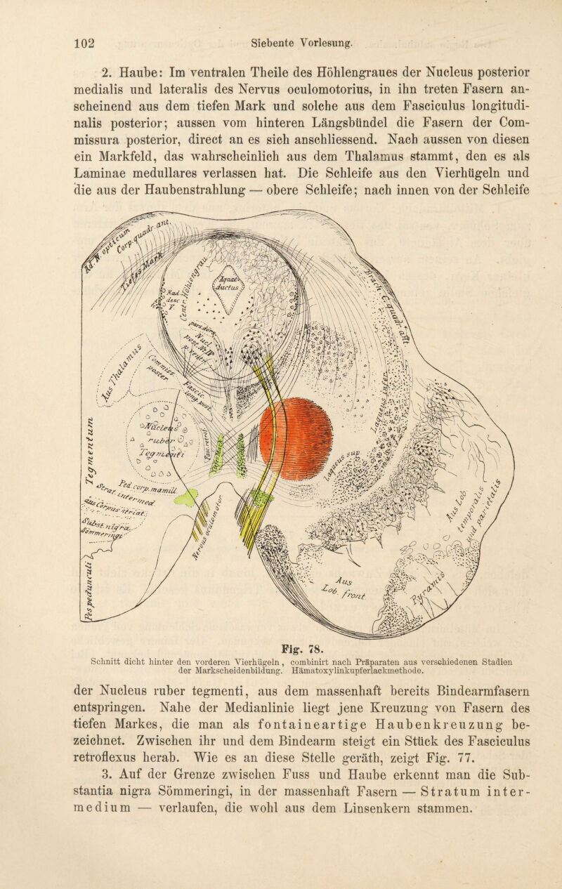 2. Haube: Im ventralen Theile des Höhlengraues der Nucleus posterior medialis und lateralis des Nervus oculomotorius, in ihn treten Fasern an¬ scheinend aus dem tiefen Mark und solche aus dem Fasciculus longitudi- nalis posterior; aussen vom hinteren Längsbündel die Fasern der Com- missura posterior, direct an es sich anschliessend. Nach aussen von diesen ein Markfeld, das wahrscheinlich aus dem Thalamus stammt, den es als Laminae medulläres verlassen hat. Die Schleife aus den Vierhügeln und die aus der Haubenstrahlung — obere Schleife; nach innen von der Schleife Fig-. 78. Schnitt dicht hinter den vorderen Vierhügeln, combinirt nach Präparaten aus verschiedenen Stadien der Markscheidenbildung. Hämatoxylinkupferlackruethode. der Nucleus ruber tegmenti, aus dem massenhaft bereits Bindearmfasern entspringen. Nahe der Medianlinie liegt jene Kreuzung von Fasern des tiefen Markes, die man als fontaineartige Haubenkreuzung be¬ zeichnet. Zwischen ihr und dem Bindearm steigt ein Stück des Fasciculus retroflexus herab. Wie es an diese Stelle geräth, zeigt Fig. 77. 3. Auf der Grenze zwischen Fuss und Haube erkennt man die Sub- stantia nigra Sömmeringi, in der massenhaft Fasern — Stratum int er- medium — verlaufen, die wohl aus dem Linsenkern stammen.