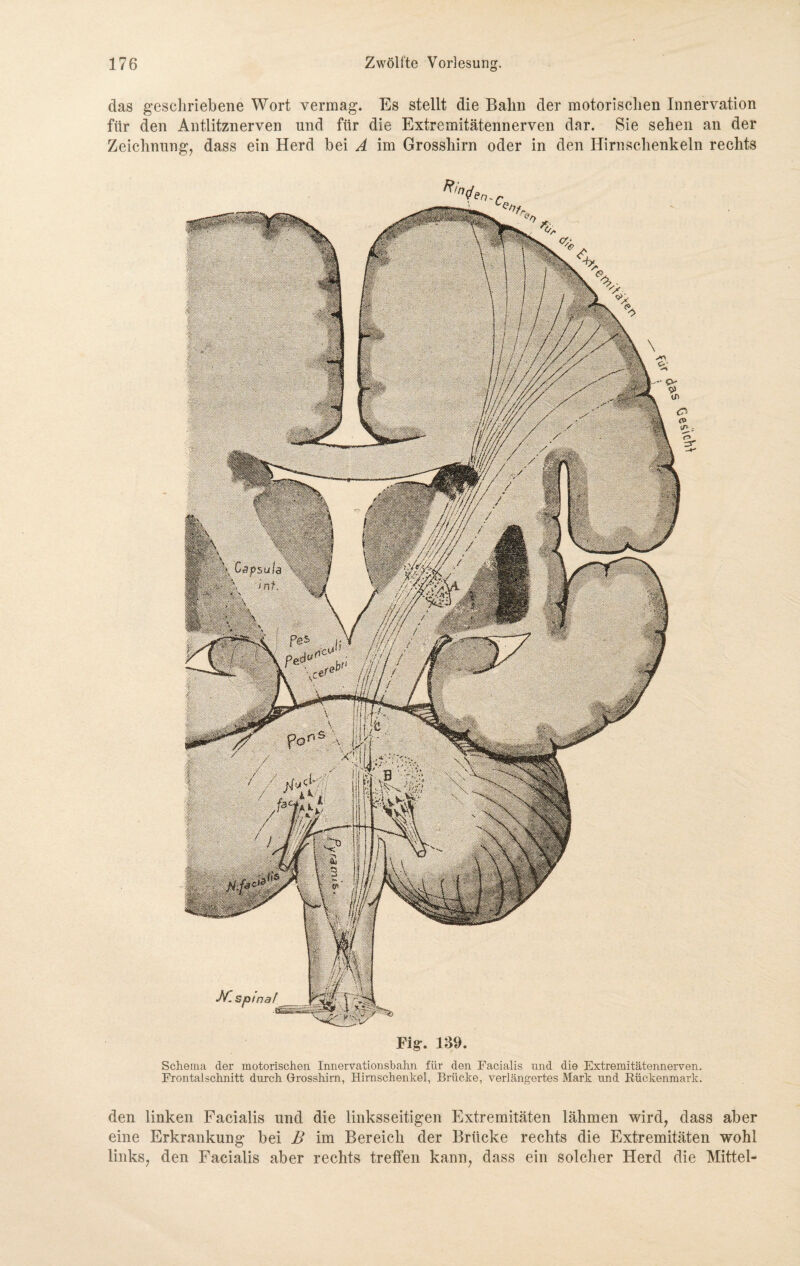 das geschriebene Wort vermag. Es stellt die Bahn der motorischen Innervation für den Antlitznerven und für die Extremitätennerven dar. Sie sehen an der Zeichnung, dass ein Herd bei A im Grosshirn oder in den Hirnschenkeln rechts Fig. 139. Schema der motorischen Innervationsbahn für den Facialis und die Extremitätennerven. Frontal schnitt durch Grosshirn, Himschenkel, Brücke, verlängertes Mark und Rückenmark. den linken Facialis und die linksseitigen Extremitäten lähmen wird, dass aber eine Erkrankung bei B im Bereich der Brücke rechts die Extremitäten wohl links, den Facialis aber rechts treffen kann, dass ein solcher Herd die Mittel-