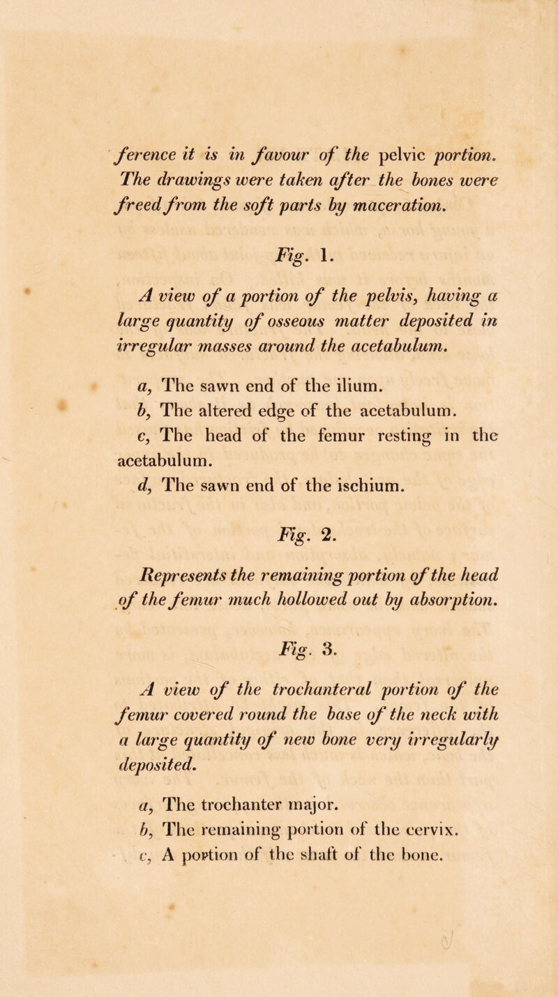 ference it is in favour of the pelvic portion. The drawings wen'e taken after the hones were freed from the soft parts hy maceration. Fig. 1. A view of a portion of the pelvis^ having a large quantity of osseous matter deposited in irregular masses around the acetabulum, a, The sawn end of the ilium. by The altered edge of the acetabulum. Cy The head of the femur resting in the acetabulum. dy The sawn end of the ischium. Fig, 2. Represents the remaining portion of the head of the femur much hollowed out hy absorption. Fig, 3. A view of the trochanteral portion of the femur covered round the base of the neck with a large quantity of new bone very irregularly deposited, Uy The trochanter major. by The remaining portion of the cervix. Cy A portion of the shaft of the bone.