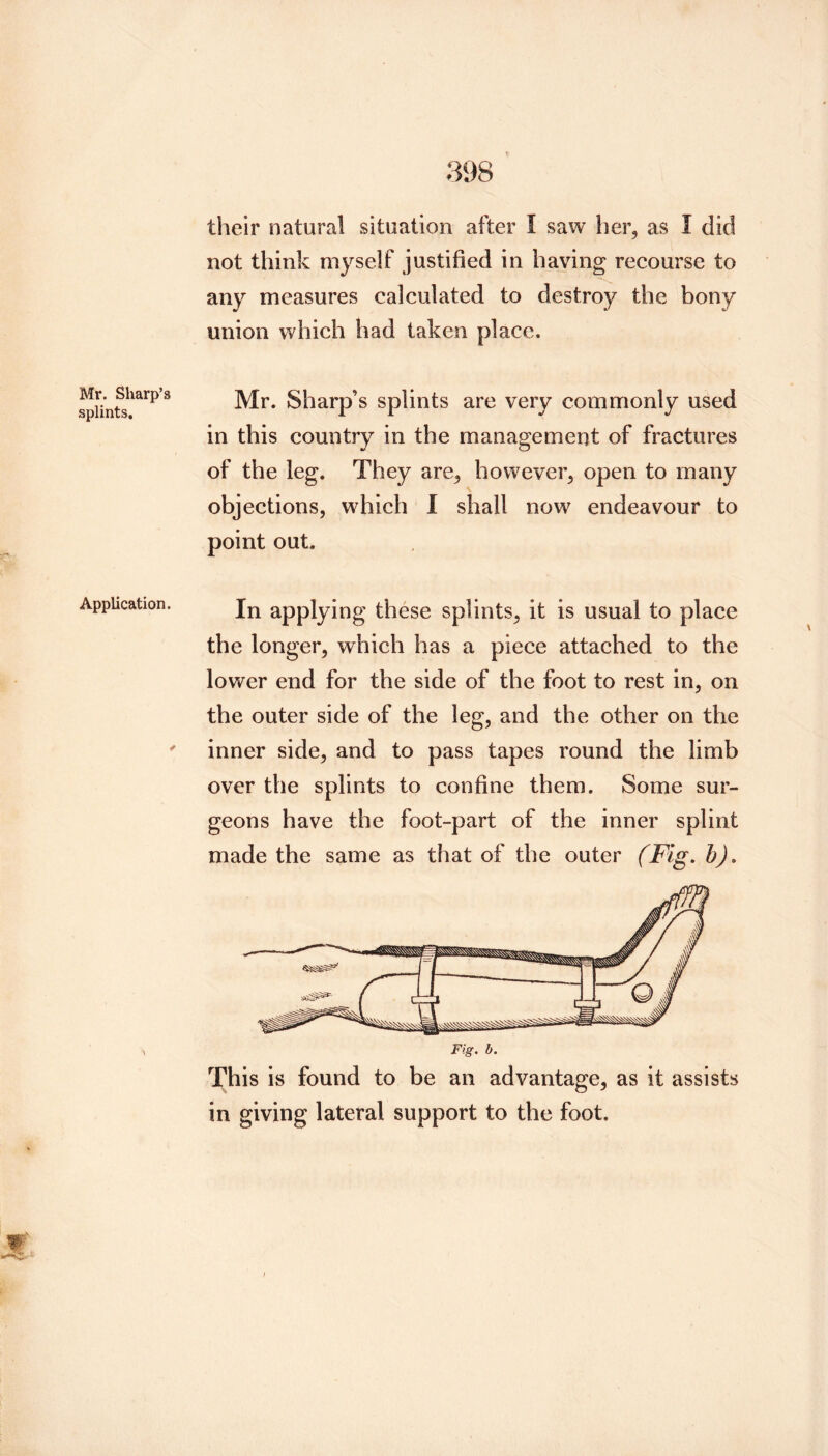 Mr. Sharp’s splints. Application. their natural situation after I saw her, as I did not think myself justified in having recourse to any measures calculated to destroy the bony union which had taken place. Mr. Sharp’s splints are very commonly used in this country in the management of fractures of the leg. They are, however, open to many objections, which I shall now endeavour to point out. In applying these splints, it is usual to place the longer, which has a piece attached to the lovv^er end for the side of the foot to rest in, on the outer side of the leg, and the other on the inner side, and to pass tapes round the limb over the splints to confine them. Some sur- geons have the foot-part of the inner splint made the same as that of the outer (Fig. h). This is found to be an advantage, as it assists in giving lateral support to the foot.