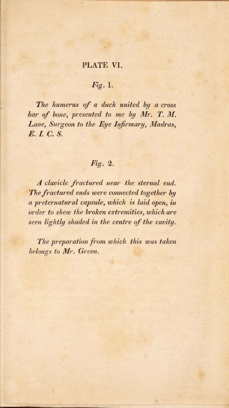 Fig, 1. The humerus of a duck united hy a cross bar of hone^ presented to me hy Mr, T, M, Lane^ Surgeon to the Eye Irfirmary^ Madras, E, I, C, S, Fig, 2. A clavicle fractured near the sternal end. The fractured ends were connected together by a preternatural capsule, which is laid open, in order to shew the broken extremities, which are seen lightly shaded in the centre of the cavity. The preparation from which this was taken he Ions s to Mr, Green,