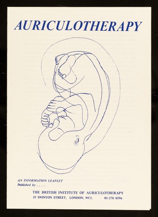 Auriculotherapy.