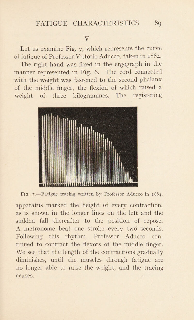 V Let us examine Fig. 7, which represents the curve of fatigue of Professor Vittorio Aducco, taken in 1884. The right hand was fixed in the ergograph in the manner represented in Fig. 6. The cord connected with the weight was fastened to the second phalanx of the middle finger, the flexion of which raised a weight of three kilogrammes. The registering Fig. 7.—Fatigue tracing written by Professor Aducco in 1884. apparatus marked the height of every contraction, as is shown in the longer lines on the left and the sudden fall thereafter to the position of repose. A metronome beat one stroke every two seconds. Following this rhythm, Professor Aducco con- tinued to contract the flexors of the middle finger. We see that the length of the contractions gradually diminishes, until the muscles through fatigue are no longer able to raise the weight, and the tracing ceases.