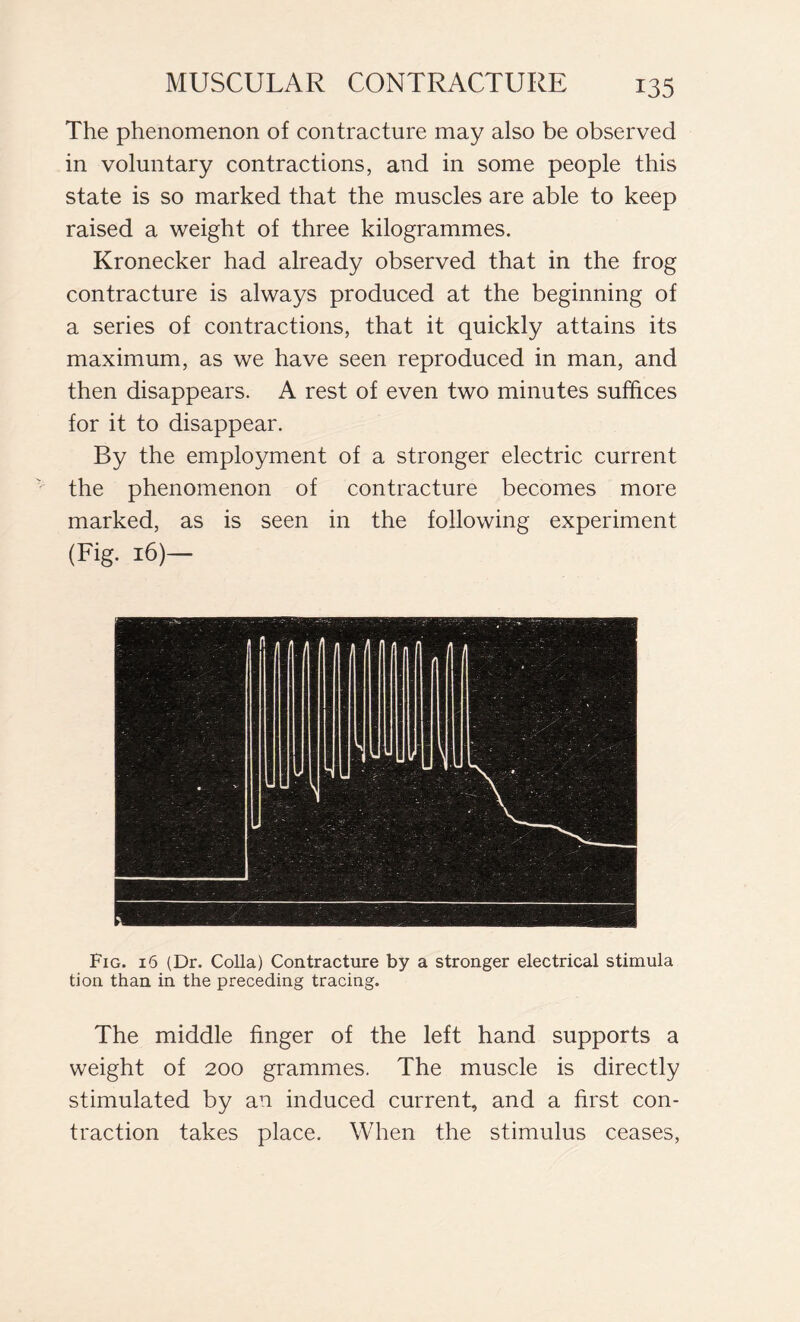 The phenomenon of contracture may also be observed in voluntary contractions, and in some people this state is so marked that the muscles are able to keep raised a weight of three kilogrammes. Kronecker had already observed that in the frog contracture is always produced at the beginning of a series of contractions, that it quickly attains its maximum, as we have seen reproduced in man, and then disappears. A rest of even two minutes suffices for it to disappear. By the employment of a stronger electric current the phenomenon of contracture becomes more marked, as is seen in the following experiment (Fig. 16)— Fig. 16 (Dr. Colla) Contracture by a stronger electrical stimula tion than in the preceding tracing. The middle finger of the left hand supports a weight of 200 grammes. The muscle is directly stimulated by an induced current, and a first con- traction takes place. When the stimulus ceases,