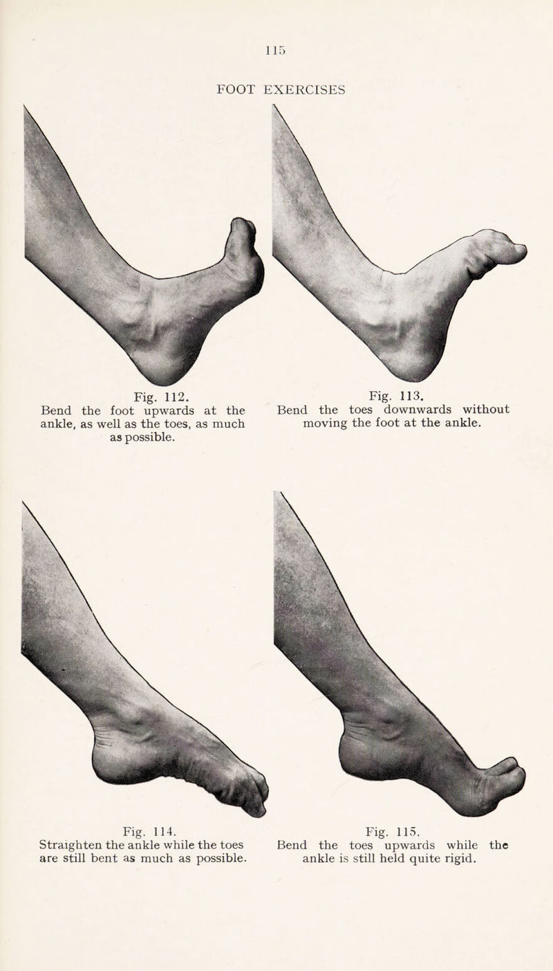 FOOT EXERCISES Fig. 112. Bend the foot upwards at the ankle, as well as the toes, as much as possible. Fig. 113. Bend the toes downwards without moving the foot at the ankle. Fig. 114. Straighten the ankle while the toes are still bent as much as possible. Fig. 115. Bend the toes upwards while the ankle is still held quite rigid.