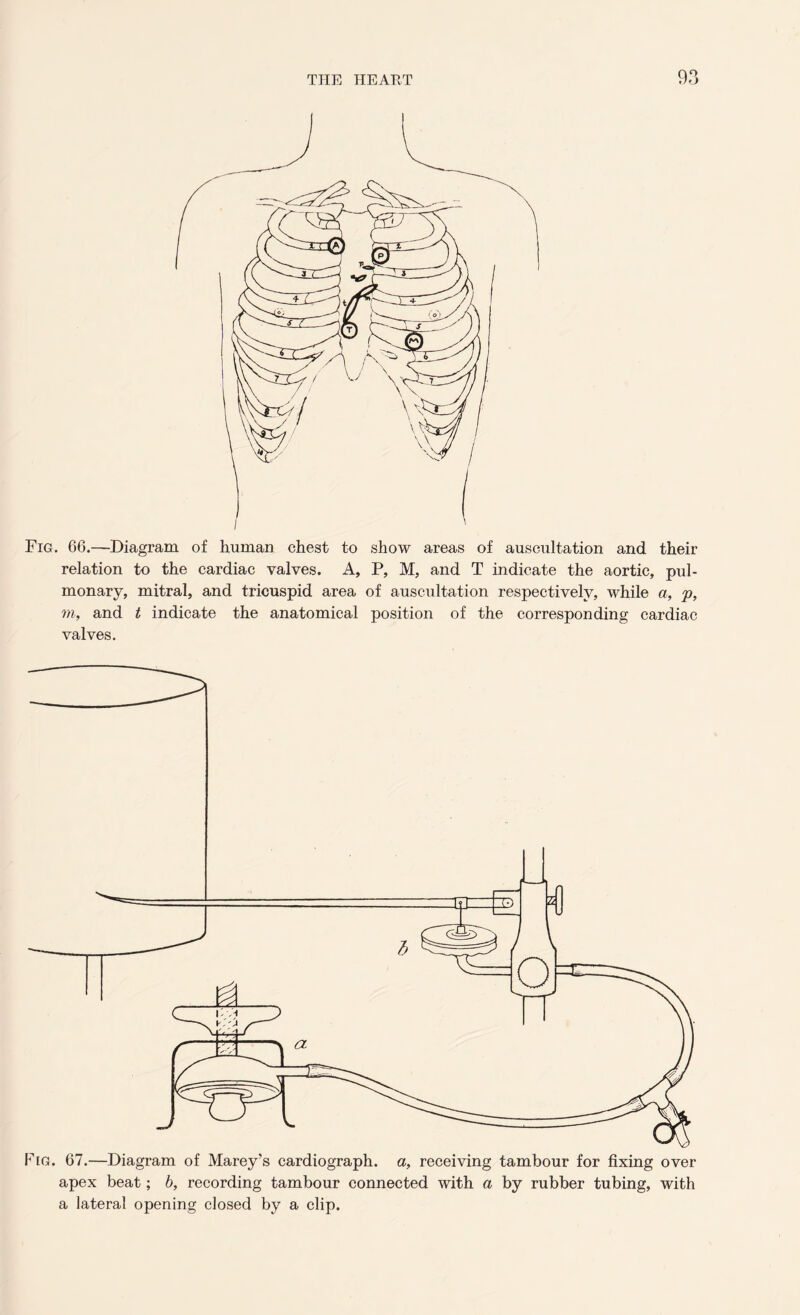 Fig. 66.—Diagram of human chest to show areas of auscultation and their relation to the cardiac valves. A, P, M, and T indicate the aortic, pul- monary, mitral, and tricuspid area of auscultation respectively, while a, p, m, and t indicate the anatomical position of the corresponding cardiac valves. apex beat; b, recording tambour connected with a by rubber tubing, with a lateral opening closed by a clip.