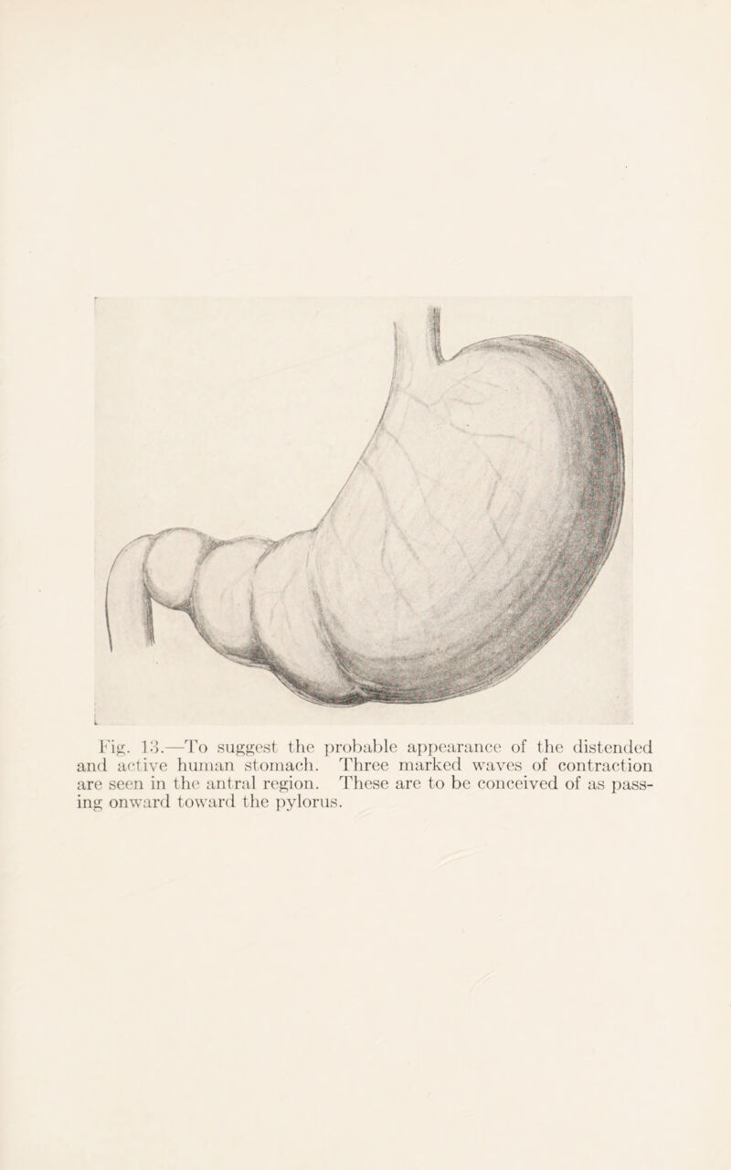 Fig. 13.—To suggest the probable appearance of the distended and active human stomach. Three marked waves of contraction are seen in the antral region. These are to be conceived of as pass- ing onward toward the pylorus.