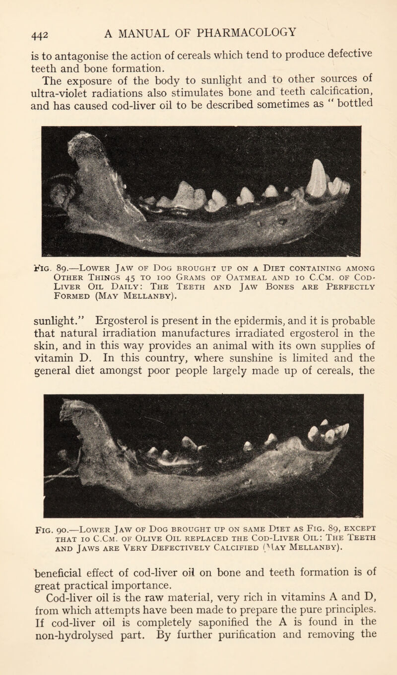 is to antagonise the action of cereals which tend to produce defective teeth and bone formation. The exposure of the body to sunlight and to other sources of ultra-violet radiations also stimulates bone and teeth calcification, and has caused cod-liver oil to be described sometimes as “ bottled Fig. 89,—Lower Jaw of Dog brought up on a Diet containing among Other Things 45 to ioo Grams of Oatmeal and 10 C.Cm. of Cod- Liver Oil Daily: The Teeth and Jaw Bones are Perfectly Formed (May Mellanby). sunlight.” Ergosterol is present in the epidermis, and it is probable that natural irradiation manufactures irradiated ergosterol in the skin, and in this way provides an animal with its own supplies of vitamin D. In this country, where .sunshine is limited and the general diet amongst poor people largely made up of cereals, the Fig. 90.—Lower Jaw of Dog brought up on same Diet as Fig. 89, except that 10 C.Cm. of Olive Oil replaced the Cod-Liver Oil: The Teeth AND Jaws are Very Defectively Calcified (’'Iay Mellanby). beneficial effect of cod-liver oil on bone and teeth formation is of great practical importance. Cod-liver oil is the raw material, very rich in vitamins A and D, from which attempts have been made to prepare the pure principles. If cod-liver oil is completely saponified the A is found in the non-hydrolysed part. By further purification and removing the