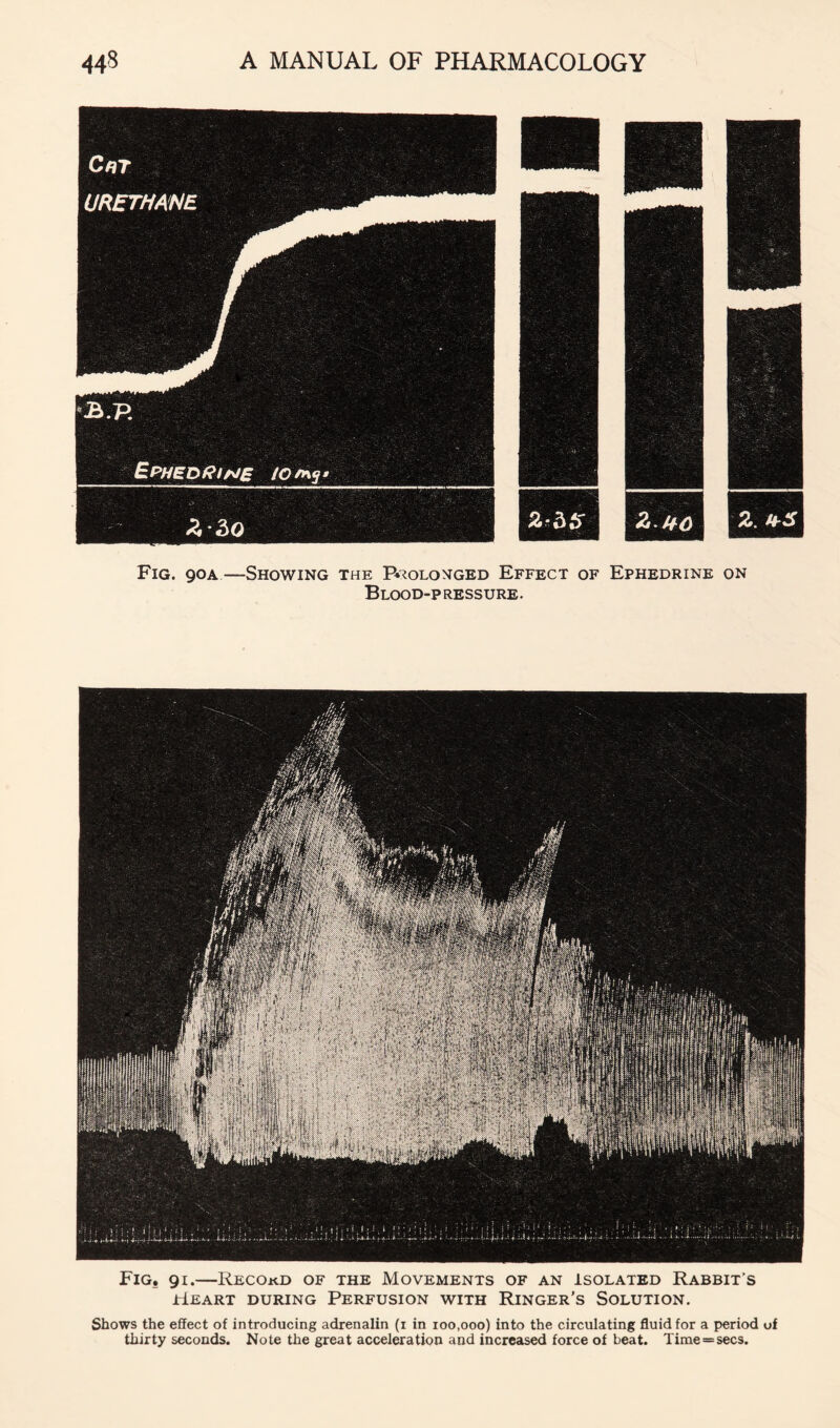 C/JT ’^.P. BPHEORiNe AP/ny* Fig. 90A—Showing the P*:?olonged Effect of Ephedrine on Blood-pressure. Fig. 91.—Record of the Movements of an Isolated Rabbit’s Heart during Perfusion with Ringer's Solution, Shows the effect of introducing adrenalin (i in 100,000) into the circulating fluid for a period of thirty seconds. Note the great acceleration and increased force of beat. Time = secs.
