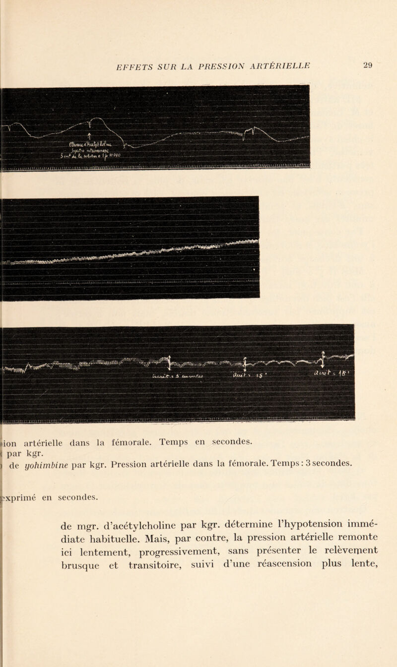 -«'<•< Ht n muni IPiinllilInl/lilIlli .. Ji.iiu.fiD Mihuytmoc 5 o»/ o l.pAm îion artérielle dans la fémorale. Temps en secondes. « par kgr. > de yohimbine par kgr. Pression artérielle dans la fémorale. Temps : 3 secondes. Imprimé en secondes. de mgr. d’acétylcholine par kgr. détermine l’hypotension immé- diate habituelle. Mais, par contre, la pression artérielle remonte ici lentement, progressivement, sans présenter le relèvement brusque et transitoire, suivi d’une réascension plus lente,