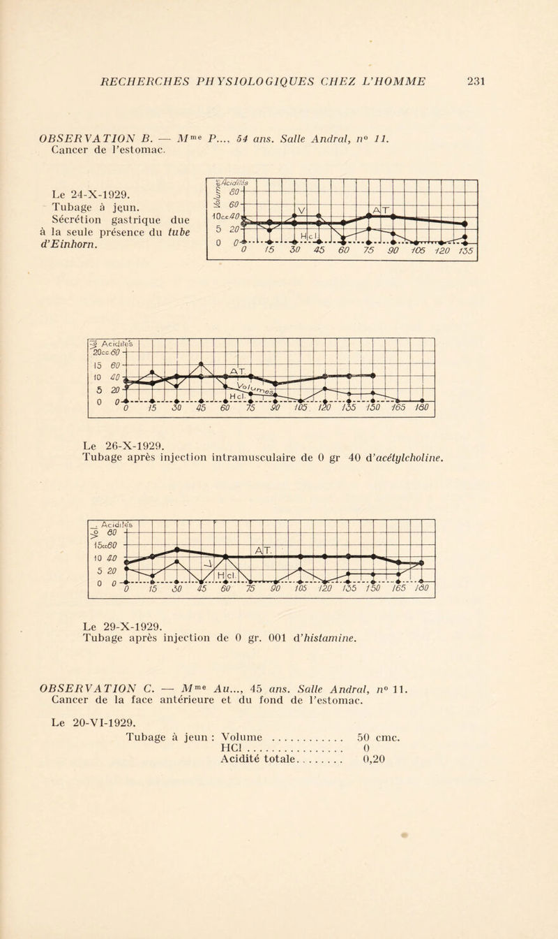 OBSERVATION B. — Mme P..., 54 ans. Salle Andral, n° 11. Cancer de l’estomac. Le 24-X-1929. Tubage à jçun. Sécrétion gastrique due à la seule présence du tube d’Einhorn. Le 26-X-1929. Tubage après injection intramusculaire de 0 gr 40 d’acétylcholine. Le 29-X-1929. Tubage après injection de 0 gr. 001 d’histamine. OBSERVATION C. — Mme Au..., 45 ans. Salle Andral, n° 11. Cancer de la face antérieure et du fond de l’estomac. Le 20-VI-1929. Tubage à jeun : Volume 50 cmc. HCl 0 Acidité totale 0,20