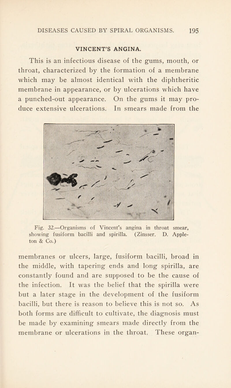 VINCENT’S ANGINA. This is an infectious disease of the gums, mouth, or throat, characterized by the formation of a membrane which may be almost identical with the diphtheritic membrane in appearance, or by ulcerations which have a punched-out appearance. On the gums it may pro- duce extensive ulcerations. In smears made from the Fig. 32.—Organisms of Vincent’s angina in throat smear, showing fusiform bacilli and spirilla. (Zinsser. D. Apple- ton & Co.) membranes or ulcers, large, fusiform bacilli, broad in the middle, with tapering ends and long spirilla, are constantly found and are supposed to be the cause of the infection. It was the belief that the spirilla were but a later stage in the development of the fusiform bacilli, but there is reason to believe this is not so. As both forms are difficult to cultivate, the diagnosis must be made by examining smears made directly from the membrane or ulcerations in the throat. These organ-