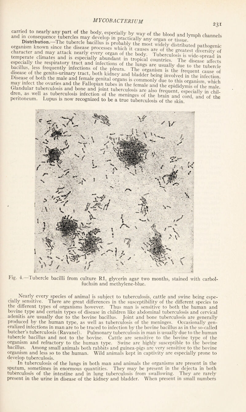 character and may attack nearly every organ of the booJv T.ihpr ? greatest diversity of clinuUes and is especially Steffi especially the respiratory tract and infections of the lunes are n=1ialhr a f t u , bacillus, less frequently infections of the pleura The Nanism k the fl U tubercl<; disease of the gemto-urinary tract both kidney and bladdef being involved inThe infection Disease of both the male and female genital organs is commonlv Hue in n; 1 mIectu1?1?- may infect the ovaries and the Fallopian tubesTn Glandular tuberculosis and bone and joint tuberculosis are also frequent especially in^hd dren as well as tuberculosis infection of the meninges of the brail and cord and of the peritoneum. Lupus is now recognized to be a true tuberculosis of the skin ’ Fig. 4. d ubercle bacilli from culture Rl, glycerin agar two months, stained with carbol- fuchsin and methylene-blue. Nearly every species of animal is subject to tuberculosis, cattle and swine being espe- cially sensitive. There are great differences in the susceptibility of the different species to the different types of organisms however. Thus man is sensitive to both the human and bovine type and certain types of disease in children like abdominal tuberculosis and cervical adenitis are usually due to the bovine bacillus. Joint and bone tuberculosis are generally produced by the human type, as well as tuberculosis of the meninges. Occasionally gen- eralized infections in man are to be traced to infection by the bovine bacillus as in the so-called butcher’s tuberculosis (Ravanel). Pulmonary tuberculosis in man is usually due to the human tubercle bacillus and not to the bovine. Cattle are sensitive to the bovine type of the organism and refractory to the human type. Swine are highly susceptible to the bovine bacillus. Among small animals both rabbits and guinea-pigs are very sensitive to the bovine organism and less so to the human. Wild animals kept in captivity are especially prone to develop tuberculosis. In tuberculosis of the lungs in both man and animals the organisms are present in the sputum, sometimes in enormous quantities. They may be present in the dejecta in both tuberculosis of the intestine and in lung tuberculosis from swallowing. They are rarely present in the urine in disease of the kidney and bladder. When present in small numbers