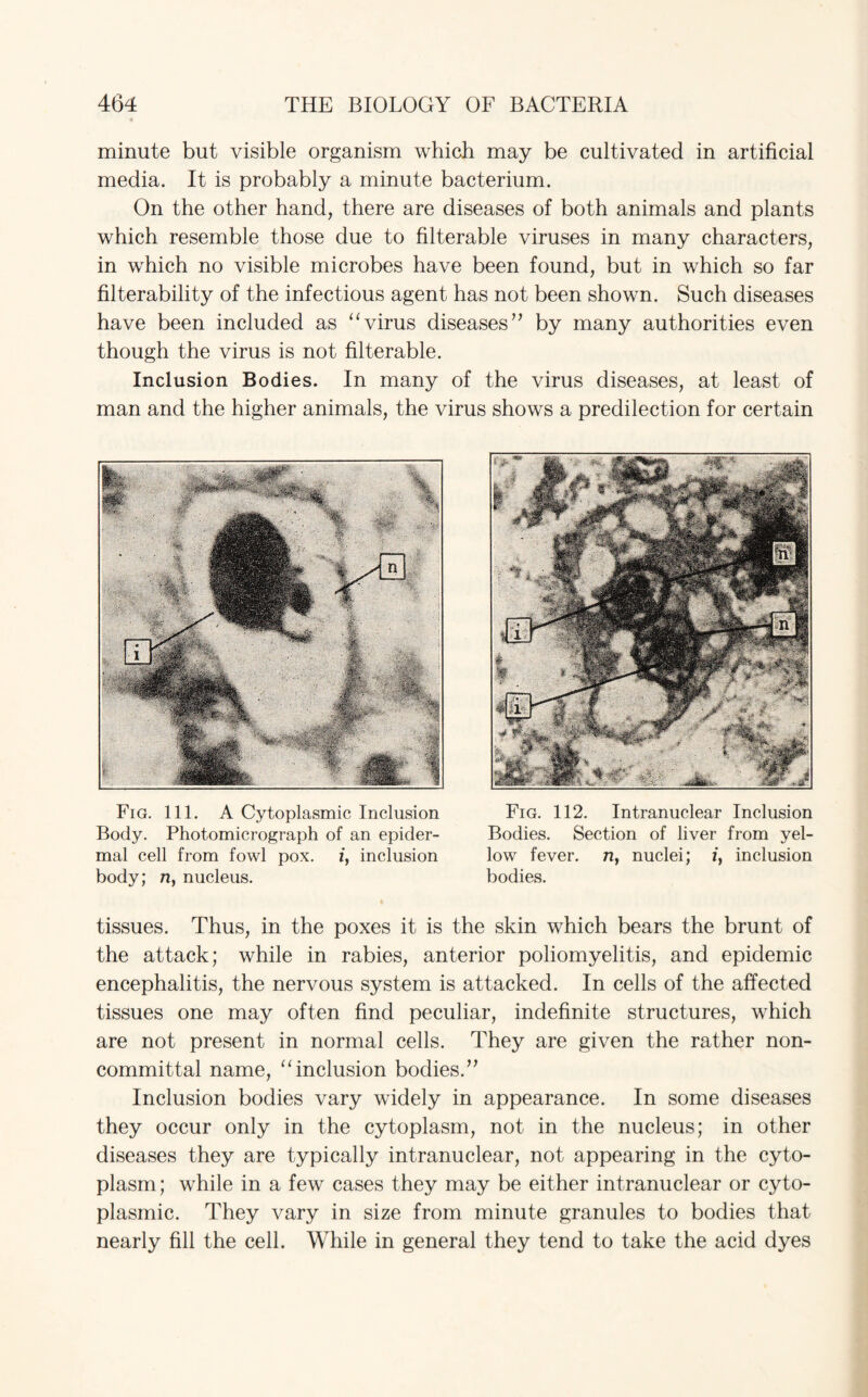 minute but visible organism which may be cultivated in artificial media. It is probably a minute bacterium. On the other hand, there are diseases of both animals and plants which resemble those due to filterable viruses in many characters, in which no visible microbes have been found, but in which so far filterability of the infectious agent has not been shown. Such diseases have been included as “virus diseases” by many authorities even though the virus is not filterable. Inclusion Bodies. In many of the virus diseases, at least of man and the higher animals, the virus shows a predilection for certain Fig. 111. A Cytoplasmic Inclusion Body. Photomicrograph of an epider¬ mal cell from fowl pox. i, inclusion body; n, nucleus. Fig. 112. Intranuclear Inclusion Bodies. Section of liver from yel¬ low fever, n, nuclei; i, inclusion bodies. tissues. Thus, in the poxes it is the skin which bears the brunt of the attack; while in rabies, anterior poliomyelitis, and epidemic encephalitis, the nervous system is attacked. In cells of the affected tissues one may often find peculiar, indefinite structures, which are not present in normal cells. They are given the rather non¬ committal name, “inclusion bodies.” Inclusion bodies vary widely in appearance. In some diseases they occur only in the cytoplasm, not in the nucleus; in other diseases they are typically intranuclear, not appearing in the cyto¬ plasm ; while in a few cases they may be either intranuclear or cyto¬ plasmic. They vary in size from minute granules to bodies that nearly fill the cell. While in general they tend to take the acid dyes