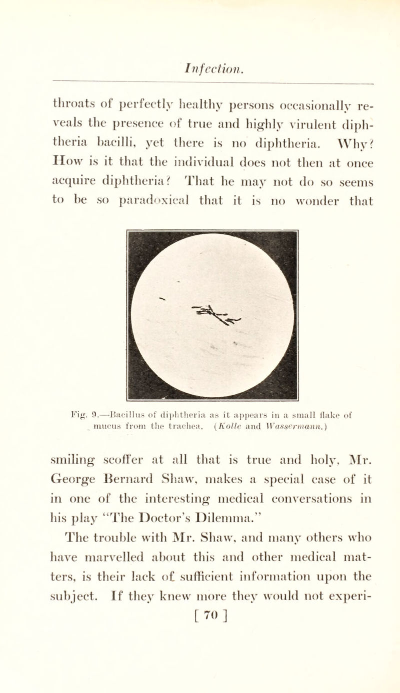 throats of perfectly healthy persons occasionally re- veals the presence of true and highly virulent diph- theria bacilli, yet there is no diphtheria. Why? ITow is it that the individual does not then at once acquire diphtheria? That he may not do so seems to he so paradoxical that it is no wonder that Fig. 9.—Bacillus of diphtheria as it appears in a small flake of mucus from the trachea. (Nolle and Wassermann.) smiling scoffer at all that is true and holy, Mr. George Bernard Shaw, makes a special ease of it in one of the interesting medical conversations in his play “The Doctor’s Dilemma. ’ The trouble with Mr. Shaw, and many others who have marvelled about this and other medical mat- ters, is their lack of sufficient information upon the subject. If they knew more they would not experi- [70]
