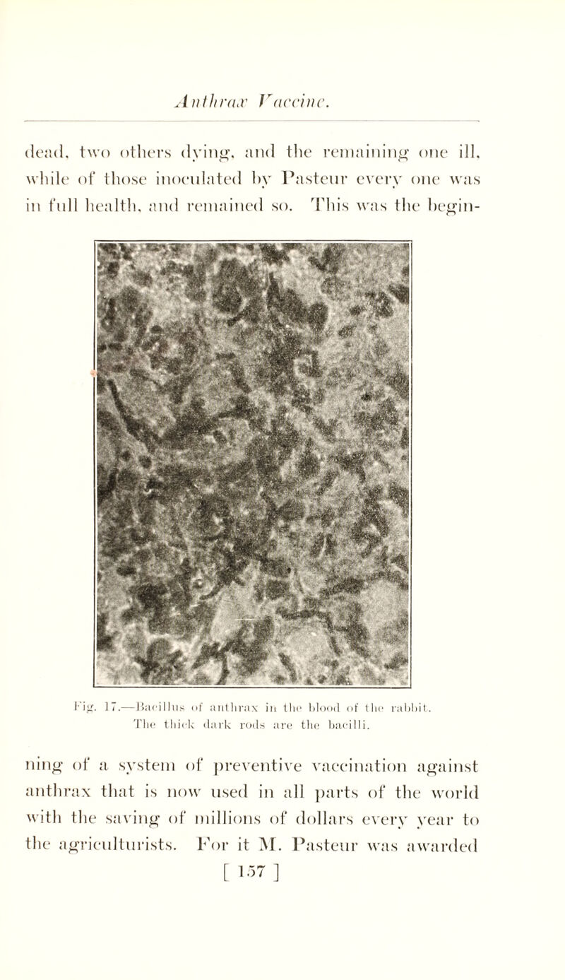 Anthrax I'archie. dead, two others dying, and the remaining one ill, while of those inoculated hy Pasteur every one was in full health, and remained so. This was the hegin- Fig. 17.—Bacillus of anthrax in the blood of the rabbit. The thick dark rods are the bacilli. ning of a system of preventive vaccination against anthrax that is now used in all parts of the world with the saving of millions of dollars every year to the agriculturists. For it M. Pasteur was awarded [ ]