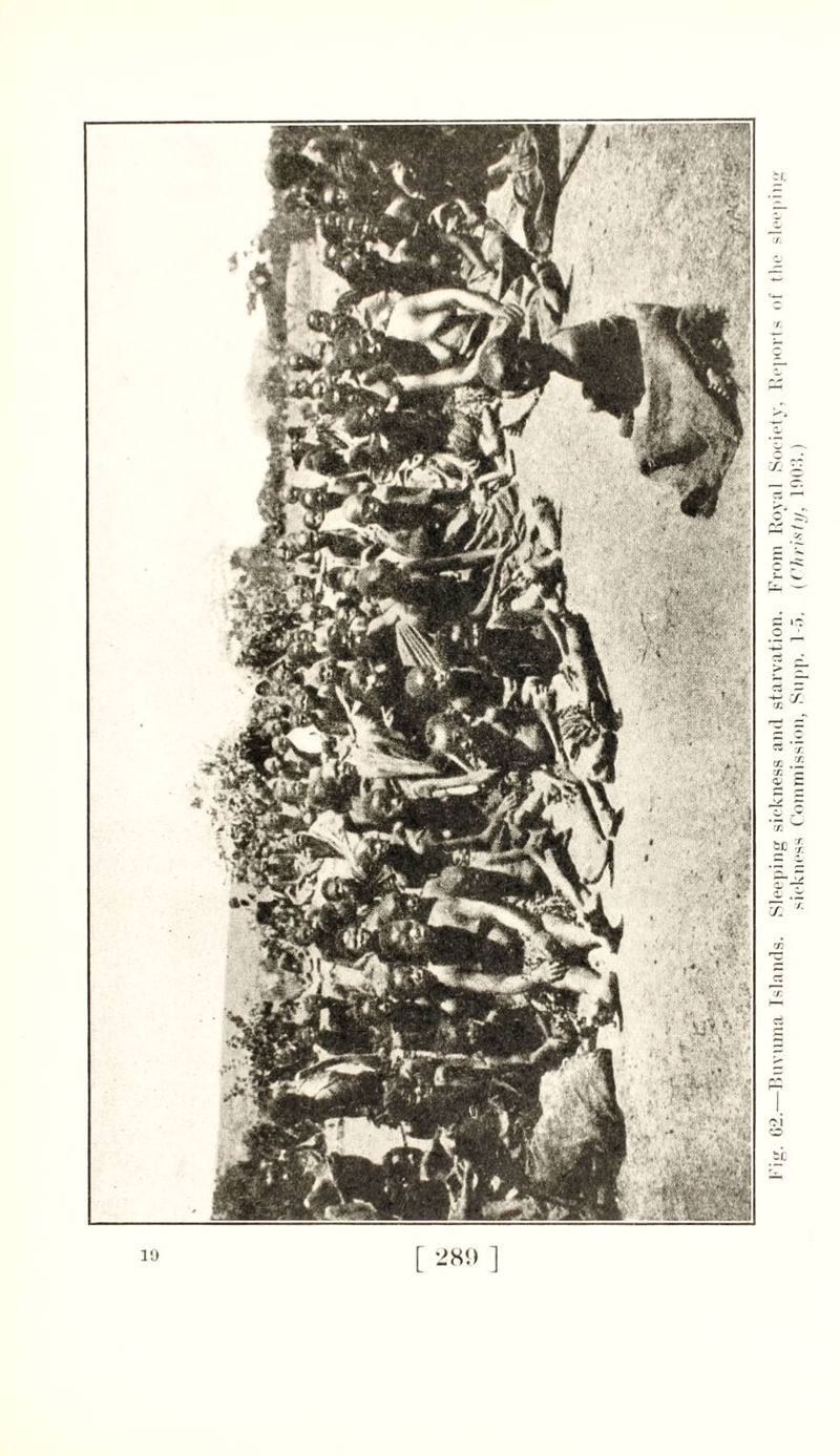 I’ig. 02.—Buvuma Islands. Sleeping sickness and starvation. From Royal Society, Reports of the sleeping sickness Commission, Snpp. 1-5. (Christy, 1903.)