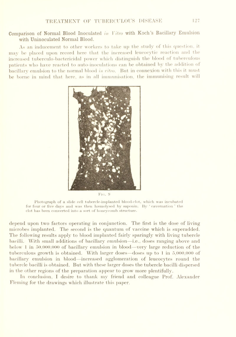 Comparison of Normal Blood Inoculated in I 'lira with Koch’s Bacillary Emulsion with Uninoculated Normal Blood. As an inducement to other workers to take up tlie study of this question, il may be placed upon record here that the increased leucocytic reaction and the increased tuberculo-bacterieidal power which distinguish the blood of tuberculous patients who have reacted to auto-inoculations can be obtained by the addition of bacillary emulsion to the normal blood in vitro. But in connexion with this it must be borne in mind that here, as in all immunisation, the immunising result will Fig. 9 Photograph of a slide cell tubercle-implanted blood-clot, which was incubated for four or five days and was then haemolysed by saponin. By ‘ cavernation ’ the clot has been converted into a sort of honeycomb structure. depend upon two factors operating in conjunction. The first is the dose of living microbes implanted. The second is the quantum of vaccine which is superadded. The following results apply to blood implanted fairly sparingly with living tubercle bacilli. With small additions of bacillary emulsion—i.e., doses ranging above and below 1 in 50,000,000 of bacillary emulsion in blood—-very large reduction of the tuberculous growth is obtained. With larger doses—doses up to 1 in 5,000,000 of bacillary emulsion in blood—increased agglomeration of leucocytes round the tubercle bacilli is obtained. But with these larger doses the tubercle bacilli dispersed in the other regions of the preparation appear to grow more plentifully. In conclusion, I desire to thank my friend and colleague Prof. Alexander Fleming for the drawings which illustrate this paper.