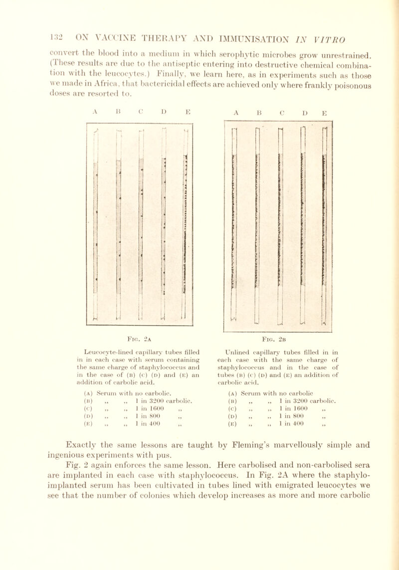 convert the blood into a medium in which serophytic microbes grow unrestrained. (These results are due to the antiseptic entering into destructive chemical combina- tion with the leucocytes.) Finally, we learn here, as in experiments such as those w e made in Africa, that bactericidal effects are achieved only where frankly poisonous doses are resorted to. A B C D E Fin. 2a ABODE Leucocyte-lined capillary tubes filled in in each case with serum containing the same charge of staphylococcus and in the case of (b) (c) (d) and (e) an addition of carbolic acid. Unlined capillary tubes filled in in each case with the same charge of staphylococcus and in the case of tubes (b) (c) (d) and (e) an addition of carbolic acid. (a) Serum with no carbolic. (A) Serum with no carbolic (B) 1 in 3200 carbolic. (B) ,, 1 in 3200 carbolic. (c) „ 1 in 1600 „ (c) >> „ 1 in 1600 ,, (D) 1 in 800 ,, (D) * » ,, 1 in 800 „ (E) 1 in 400 (E) „ 1 in 400 ,, Exactly the same lessons are taught by Fleming’s marvellously simple and ingenious experiments with pus. Fig. 2 again enforces the same lesson. Here carbolised and non-carbolised sera are implanted in each case with staphylococcus. In Fig. 2A where the staphylo- implanted serum lias been cultivated in tubes lined with emigrated leucocytes we see that the number of colonies which develop increases as more and more carbolic