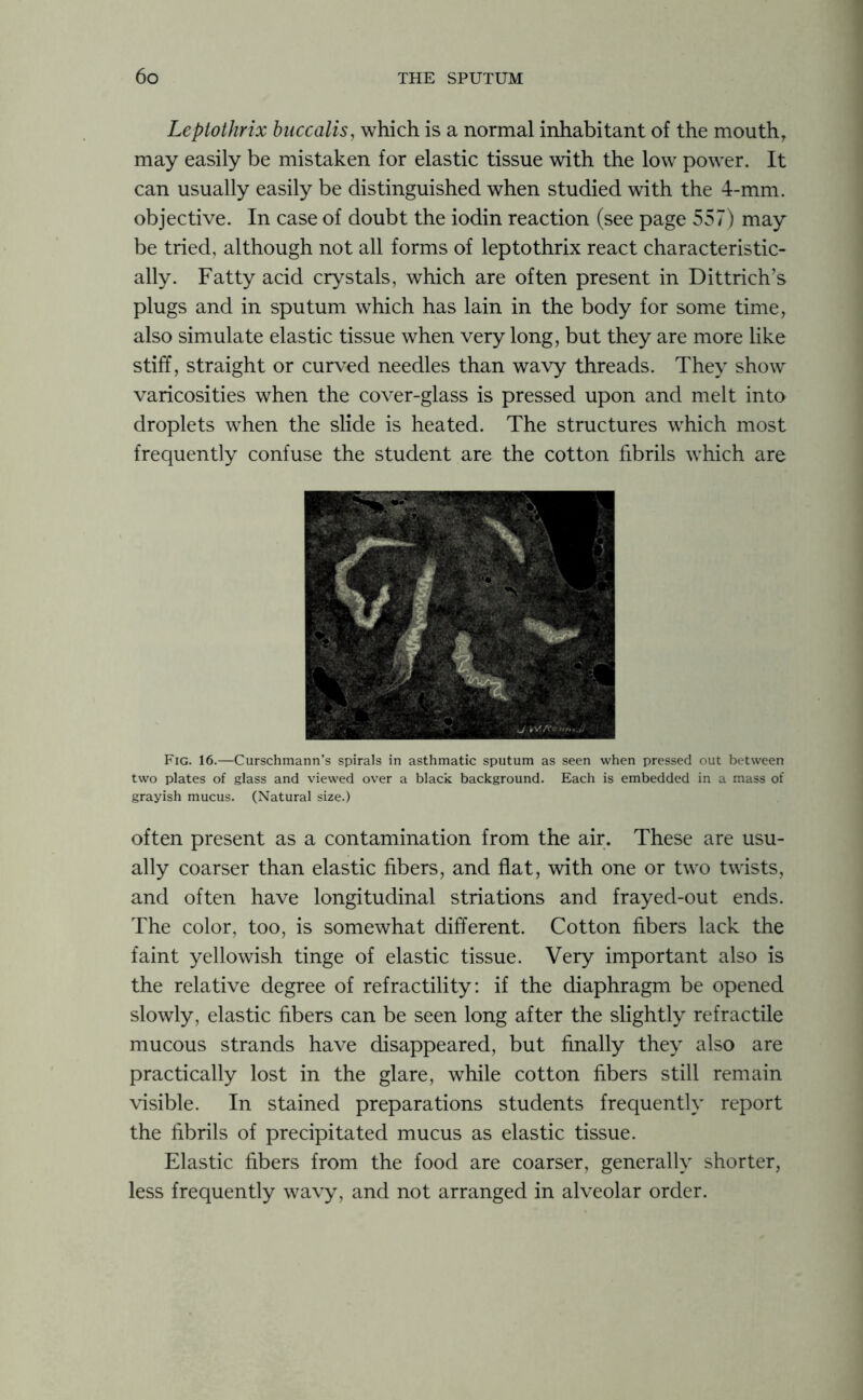 Leptothrix buccalis, which is a normal inhabitant of the mouth, may easily be mistaken for elastic tissue with the low power. It can usually easily be distinguished when studied with the 4-mm. objective. In case of doubt the iodin reaction (see page 557) may be tried, although not all forms of leptothrix react characteristic- ally. Fatty acid crystals, which are often present in Dittrich’s plugs and in sputum which has lain in the body for some time, also simulate elastic tissue when very long, but they are more like stiff, straight or curved needles than wavy threads. They show varicosities when the cover-glass is pressed upon and melt into droplets when the slide is heated. The structures which most frequently confuse the student are the cotton fibrils which are Fig. 16.—Curschmann’s spirals in asthmatic sputum as seen when pressed out between two plates of glass and viewed over a black background. Each is embedded in a mass of grayish mucus. (Natural size.) often present as a contamination from the air. These are usu- ally coarser than elastic fibers, and flat, with one or two twists, and often have longitudinal striations and frayed-out ends. The color, too, is somewhat different. Cotton fibers lack the faint yellowish tinge of elastic tissue. Very important also is the relative degree of refractility: if the diaphragm be opened slowly, elastic fibers can be seen long after the slightly refractile mucous strands have disappeared, but finally they also are practically lost in the glare, while cotton fibers still remain visible. In stained preparations students frequently report the fibrils of precipitated mucus as elastic tissue. Elastic fibers from the food are coarser, generally shorter, less frequently wavy, and not arranged in alveolar order.