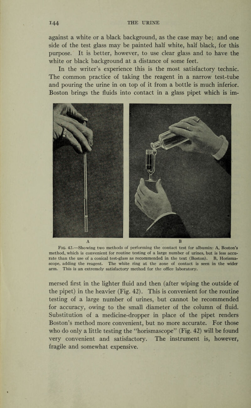 against a white or a black background, as the case may be; and one side of the test glass may be painted half white, half black, for this purpose. It is better, however, to use clear glass and to have the white or black background at a distance of some feet. In the writer’s experience this is the most satisfactory technic. The common practice of taking the reagent in a narrow test-tube and pouring the urine in on top of it from a bottle is much inferior. Boston brings the fluids into contact in a glass pipet which is im- A b Fig. 42.—Showing two methods of performing the contact test for albumin: A, Boston’s method, which is convenient for routine testing of a large number of urines, but is less accu- rate than the use of a conical test-glass as recommended in the text (Boston). B, Horisma- scope, adding the reagent. The white ring at the zone of contact is seen in the wider arm. This is an extremely satisfactory method for the office laboratory. mersed first in the lighter fluid and then (after wiping the outside of the pipet) in the heavier (Fig. 42). This is convenient for the routine testing of a large number of urines, but cannot be recommended for accuracy, owing to the small diameter of the column of fluid. Substitution of a medicine-dropper in place of the pipet renders Boston’s method more convenient, but no more accurate. For those who do only a little testing the “horismascope” (Fig. 42) will be found very convenient and satisfactory. The instrument is, however, fragile and somewhat expensive.