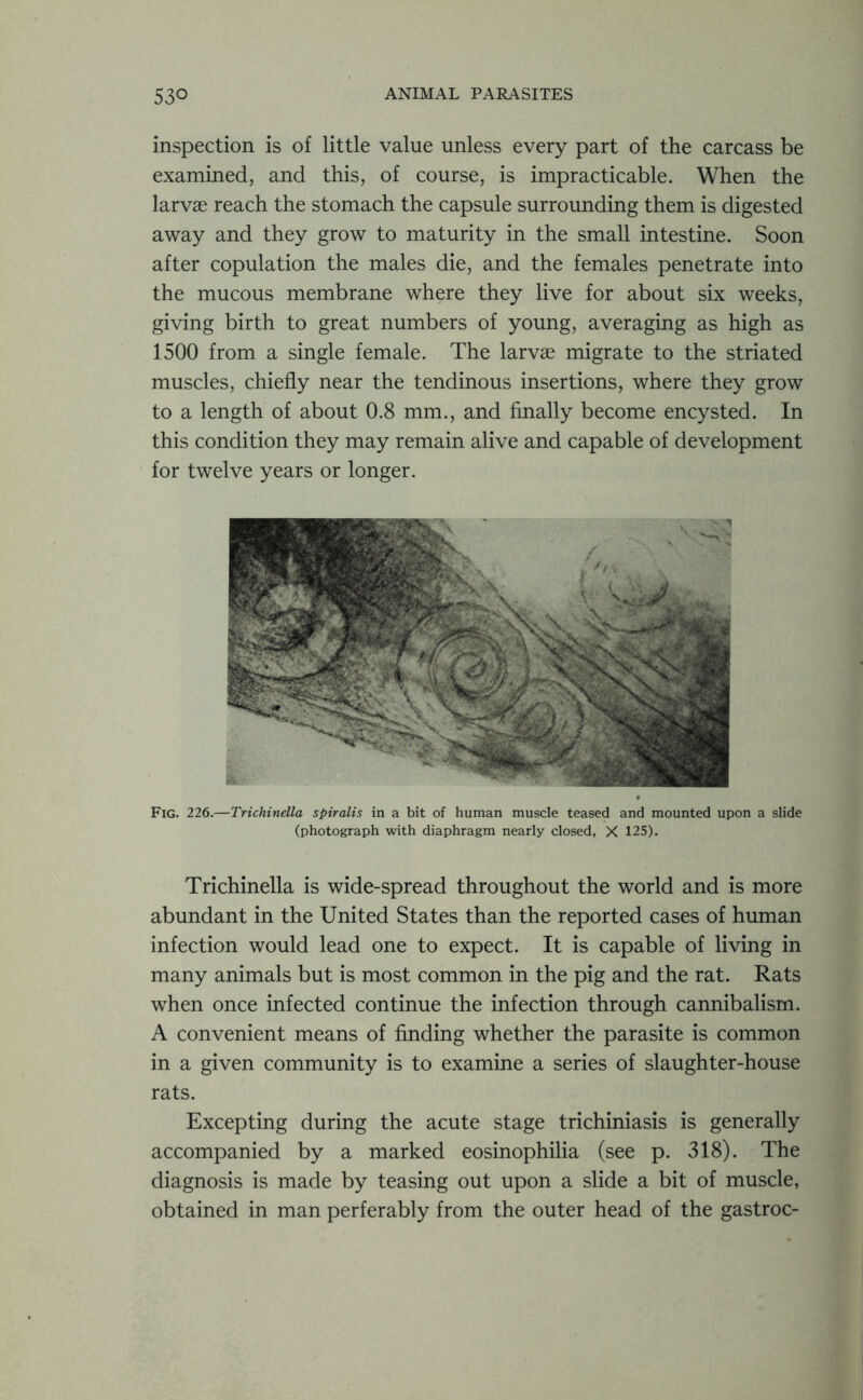 inspection is of little value unless every part of the carcass be examined, and this, of course, is impracticable. When the larvae reach the stomach the capsule surrounding them is digested away and they grow to maturity in the small intestine. Soon after copulation the males die, and the females penetrate into the mucous membrane where they live for about six weeks, giving birth to great numbers of young, averaging as high as 1500 from a single female. The larvae migrate to the striated muscles, chiefly near the tendinous insertions, where they grow to a length of about 0.8 mm., and finally become encysted. In this condition they may remain alive and capable of development for twelve years or longer. Fig. 226.—Trichinella spiralis in a bit of human muscle teased and mounted upon a slide (photograph with diaphragm nearly closed, X 125). Trichinella is wide-spread throughout the world and is more abundant in the United States than the reported cases of human infection would lead one to expect. It is capable of living in many animals but is most common in the pig and the rat. Rats when once infected continue the infection through cannibalism. A convenient means of finding whether the parasite is common in a given community is to examine a series of slaughter-house rats. Excepting during the acute stage trichiniasis is generally accompanied by a marked eosinophilia (see p. 318). The diagnosis is made by teasing out upon a slide a bit of muscle, obtained in man perferably from the outer head of the gastroc-