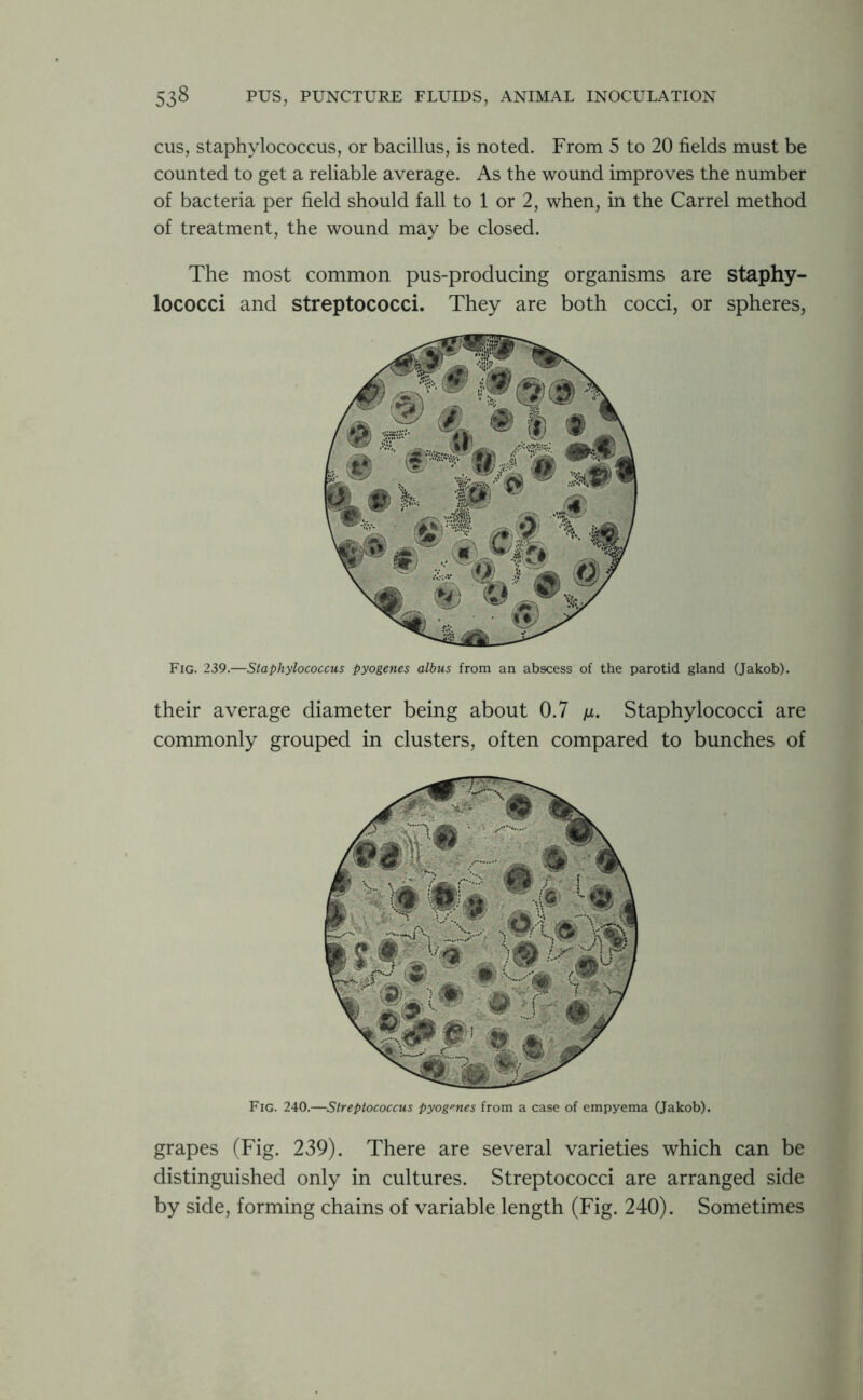 cus, staphylococcus, or bacillus, is noted. From 5 to 20 fields must be counted to get a reliable average. As the wound improves the number of bacteria per field should fall to 1 or 2, when, in the Carrel method of treatment, the wound may be closed. The most common pus-producing organisms are staphy- lococci and streptococci. They are both cocci, or spheres, Fig. 239.—Staphylococcus pyogenes albus from an abscess of the parotid gland (Jakob). their average diameter being about 0.7 /*. Staphylococci are commonly grouped in clusters, often compared to bunches of Fig. 240.—Streptococcus pyogenes from a case of empyema (Jakob). grapes (Fig. 239). There are several varieties which can be distinguished only in cultures. Streptococci are arranged side by side, forming chains of variable length (Fig. 240). Sometimes