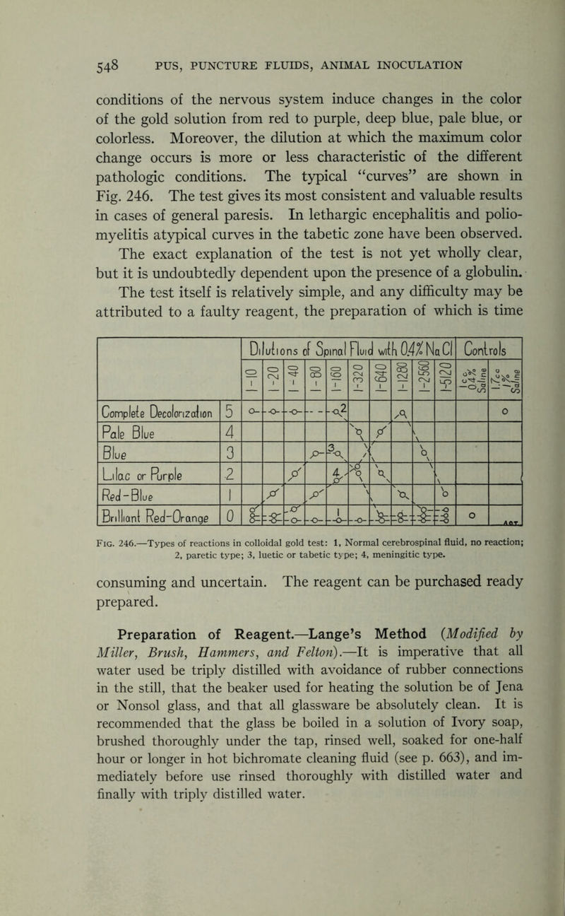 conditions of the nervous system induce changes in the color of the gold solution from red to purple, deep blue, pale blue, or colorless. Moreover, the dilution at which the maximum color change occurs is more or less characteristic of the different pathologic conditions. The typical “curves” are shown in Fig. 246. The test gives its most consistent and valuable results in cases of general paresis. In lethargic encephalitis and polio- myelitis atypical curves in the tabetic zone have been observed. The exact explanation of the test is not yet wholly clear, but it is undoubtedly dependent upon the presence of a globulin. The test itself is relatively simple, and any difficulty may be attributed to a faulty reagent, the preparation of which is time D, uiions of Spinal Fluid wd hOttN a Cl Coni ro Is CD CD CM CD 1 CD ao i CD CO 1 CD CNJ CD \ CD co S CNJ 1 CD .10 UD CNJ 1 1-5120 1 C C, 0.4% Saline U Q> — CO Complete Decolonization 5 o- --0-- --O— -<\2 \/\ 0 Pale Blue 4 \ \ / v \ Blue 3 P~ \ / \ \ Q \ Lilac or Purple 2 / \ \ 0. \ \ \ Red-Blue 1 P' \ \ V V No Brilliani Red'Orange 0 o' 8^ -&■ -o- -o- 1 --o- --o- \ & -•o o —fl-ar. Fig. 246.—Types of reactions in colloidal gold test: 1, Normal cerebrospinal fluid, no reaction; 2, paretic type; 3, luetic or tabetic type; 4, meningitic type. consuming and uncertain. The reagent can be purchased ready prepared. Preparation of Reagent.—Lange’s Method {Modified by Miller, Brush, Hammers, and Felton).—It is imperative that all water used be triply distilled with avoidance of rubber connections in the still, that the beaker used for heating the solution be of Jena or Nonsol glass, and that all glassware be absolutely clean. It is recommended that the glass be boiled in a solution of Ivory soap, brushed thoroughly under the tap, rinsed well, soaked for one-half hour or longer in hot bichromate cleaning fluid (see p. 663), and im- mediately before use rinsed thoroughly with distilled water and finally with triply distilled water.
