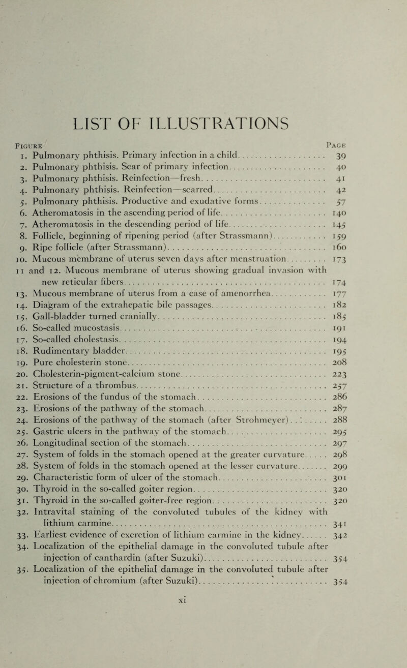 LIST OF ILLUSTRATIONS Figure Page 1. Pulmonary phthisis. Primary infection in a child 30 2. Pulmonary phthisis. Scar of primary infection 40 3. Pulmonary phthisis. Reinfection—fresh 41 4. Pulmonary phthisis. Reinfection—scarred 42 5. Pulmonary phthisis. Productive and exudative forms 57 6. Atheromatosis in the ascending period of life 140 7. Atheromatosis in the descending period of life 145 8. Follicle, beginning of ripening period (after Strassmann) 159 9. Ripe follicle (after Strassmann) 160 10. Mucous membrane of uterus seven days after menstruation 173 II and 12. Mucous membrane of uterus showing gradual Invasion with new reticular fibers 174 13. Mucous membrane of uterus from a case of amenorrhea 177 14. Diagram of the extrahepatic bile passages 182 15. Gall-bladder turned cranially 185 16. So-called mucostasis 191 17. So-called cholestasis 194 18. Rudimentary bladder 195 19. Pure cholesterin stone 208 20. Cholesterin-pigment-calcium stone 223 21. Structure of a thrombus 257 22. Erosions of the fundus of the stomach 286 23. Erosions of the pathway of the stomach 287 24. Erosions of the pathway of the stomach (after Strohmeycr). . 288 25. Gastric ulcers in the pathway of the stomach 295 26. Longitudinal section of the stomach 29^ 27. System of folds in the stomach opened at the greater curvature 298 28. System of folds in the stomach opened at the lesser curvature 299 29. Characteristic form of ulcer of the stomach 301 30. Thyroid in the so-called goiter region 320 31. Thyroid in the so-called goiter-free region 320 32. Intravital staining of the convoluted tubules of the kidney with lithium carmine 341 33. Earliest evidence of excretion of lithium carmine in the kidney 342 34. Localization of the epithelial damage in the convoluted tubule after injection of canthardin (after Suzuki) 354 35. Localization of the epithelial damage in the convoluted tubule after injection of chromium (after Suzuki) ) 354