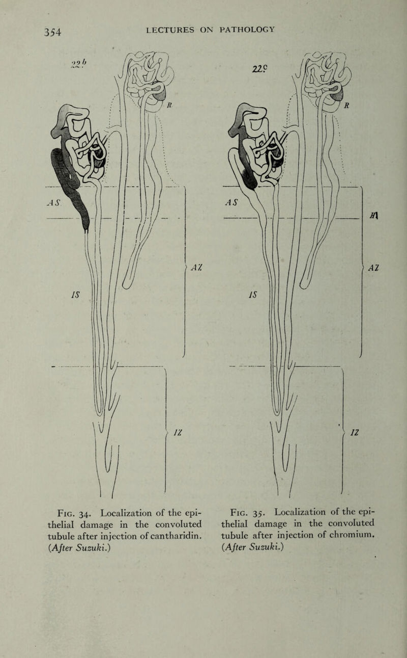 Fig. 34. Localization of the epi- thelial damage in the convoluted tubule after injection of cantharidin. (After Suzuki.) Fig. 35. Localization of the epi- thelial damage in the convoluted tubule after injection of chromium. (After Suzuki.)